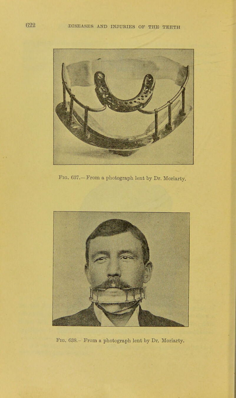 Fig. 638.- From a photograph lent by Dr. Moriarty.