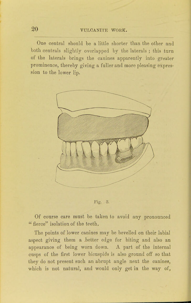 One central should be a little shorter than the other and both centrals slightly overlapped by the laterals ; this turn of the laterals brings the canines apparently into greater prominence, thereby giving a fuller and more pleasing expres- sion to the lower lip. Fig. 3. Of course care must be taken to avoid any pronounced  fierce isolation of the teeth. The points of lower canines may be bevelled on their labial aspect giving them a .better edge for biting and also an appearance of being worn down. A part of the internal cusps of the first lower bicuspids is also ground off so that they do not present such an abrupt angle next the canines, which is not natural, and would only get in the way of,