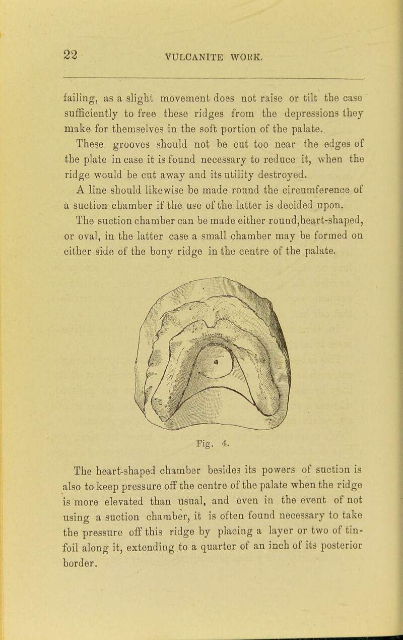 failing, as a slight movement does not raise or tilt the case sufficiently to free these ridges from the depressions they make for themselves in the soft portion of the palate. These grooves should not be cut too near the edges of the plate incase it is found necessary to reduce it, when the ridge would be cut away and its utility destroyed. A line should likewise be made round the circumference of a suction chamber if the use of the latter is decided upon. The suction chamber can be made either round,heart-shaped, or oval, in the latter case a small chamber may be formed on either side of the bony ridge in the centre of the palate. Fig. 4. The heart-shaped chamber besides its powers of suction is also to keep pressure off the centre of the palate when the ridge is more elevated than usual, and even in the event of not using a suction chamber, it is often found necessary to take the pressure off this ridge by placing a layer or two of tin- foil along it, extending to a quarter of an inch of its posterior border.