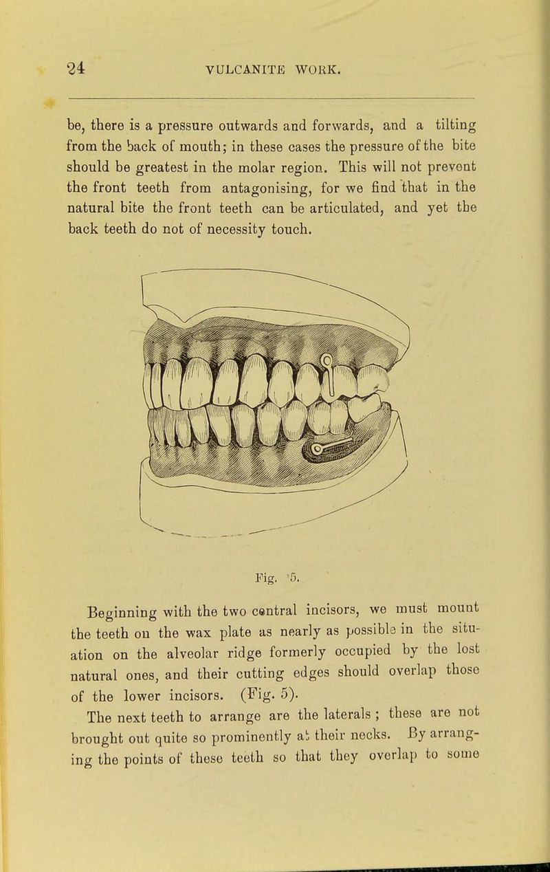 be, there is a pressure outwards and forwards, and a tilting from the back of mouth; in these cases the pressure of the bite should be greatest in the molar region. This will not prevent the front teeth from antagonising, for we find that in the natural bite the front teeth can be articulated, and yet the back teeth do not of necessity touch. Fig. '5. Beginning with the two central incisors, we must mount the teeth on the wax plate as nearly as possible in the situ- ation on the alveolar ridge formerly occupied by the lost natural ones, and their cutting edges should overlap those of the lower incisors. (Fig. 5). The next teeth to arrange are the laterals ; these are not brought out quite so prominently ab their necks. By arrang- ing the points of these teeth so that they overlap to some