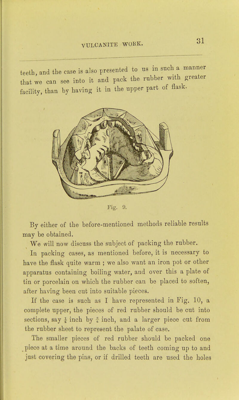 teeth, and the case is also presented to ns in such a manner that we can see into it and pack the rubber with greater facility, than by having it in the upper part of flask. By either of the before-mentioned methods reliable results may be obtained. We will now discuss the subject of packing the rubber. In packing cases, as mentioned before, it is necessary to have the flask quite warm ; we also want an iron pot or other apparatus containing boiling water, and over this a plate of tin or porcelain on which the rubber can be placed to soften, after having been cut into suitable pieces. If the case is such as I have represented in Fig. 10, a complete upper, the pieces of red rubber should be cut into sections, say ^ inch by J inch, and a larger pieoe cut from the rubber sheet to represent the palate of case. The smaller pieces of red rubber should be packed one piece at a time around the backs of teeth coming up to and just covering the pins, or if drilled teeth are used the holes