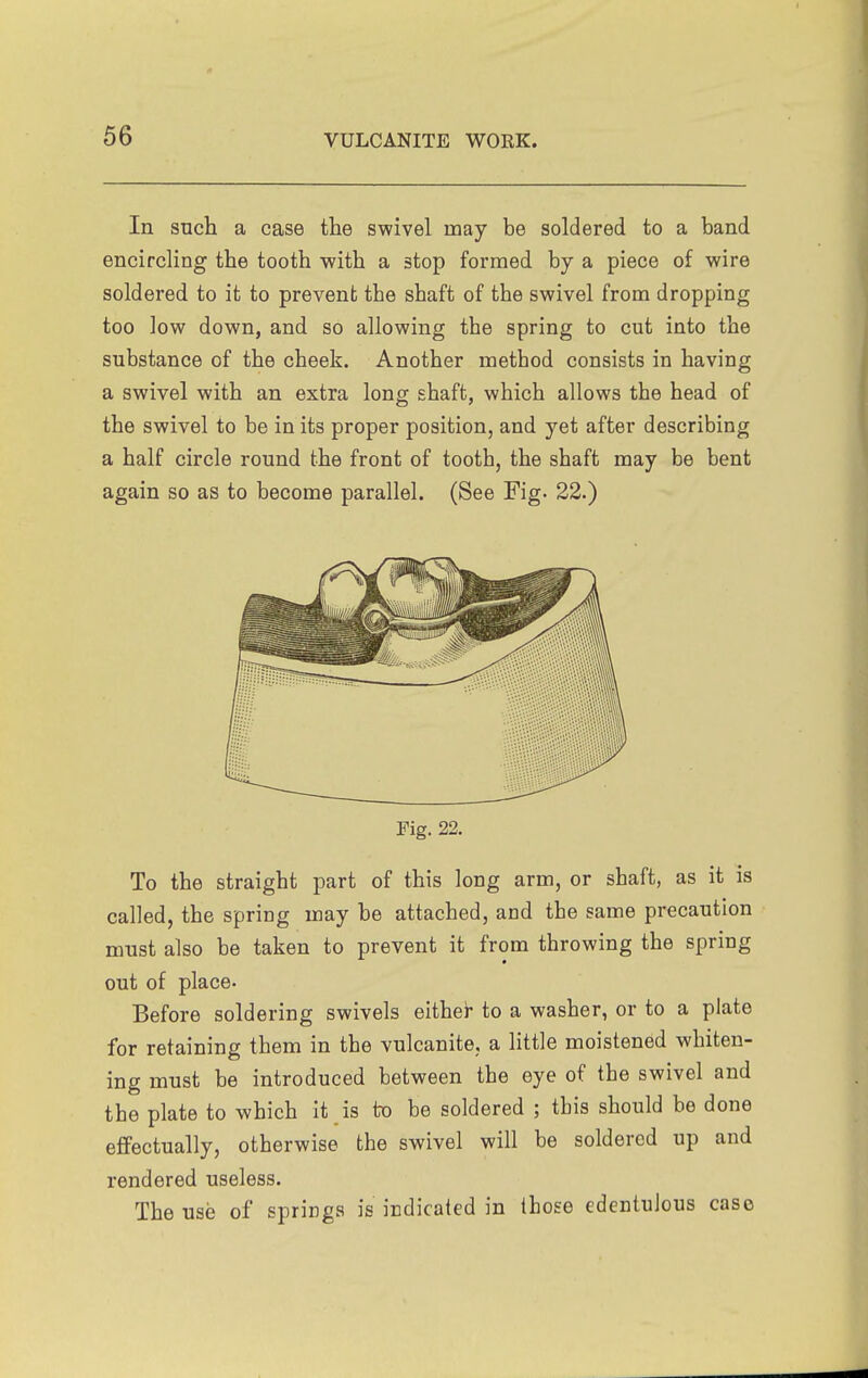 In such a case the swivel may be soldered to a band encircling the tooth with a stop formed by a piece of wire soldered to it to prevent the shaft of the swivel from dropping too low down, and so allowing the spring to cut into the substance of the cheek. Another method consists in having a swivel with an extra long shaft, which allows the head of the swivel to be in its proper position, and yet after describing a half circle round the front of tooth, the shaft may be bent again so as to become parallel. (See Fig- 22.) Fig. 22. To the straight part of this long arm, or shaft, as it is called, the spring may be attached, and the same precaution must also be taken to prevent it from throwing the spring out of place- Before soldering swivels either to a washer, or to a plate for retaining them in the vulcanite, a little moistened whiten- ing must be introduced between the eye of the swivel and the plate to which it is to be soldered ; this should be done eflfectually, otherwise the swivel will be soldered up and rendered useless. The use of springs is indicated in those edentulous case