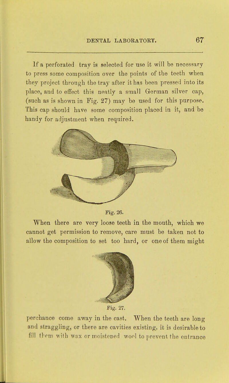 If a perforated tray is selected for use it will be necessary to press some composition over the points of the teeth when they project through the tray after it has been pi*essed into its place, and to effect this neatly a small German silver cap, (such as is shown in Fig. 27) may be used for this purpose. This cap should have some composition placed in it, and be handy for adjustment when required. Fig. 26. When there are very loose teeth in the mouth, which we cannot get permission to remove, care must be taken not to allow the composition to set too hard, or one of them might JFig. 27. perchance come away in the cast. When the teeth are long and straggling, or there are cavities existing, it is desirable to fill thrm with wax or moistened wool to prevent the entrance