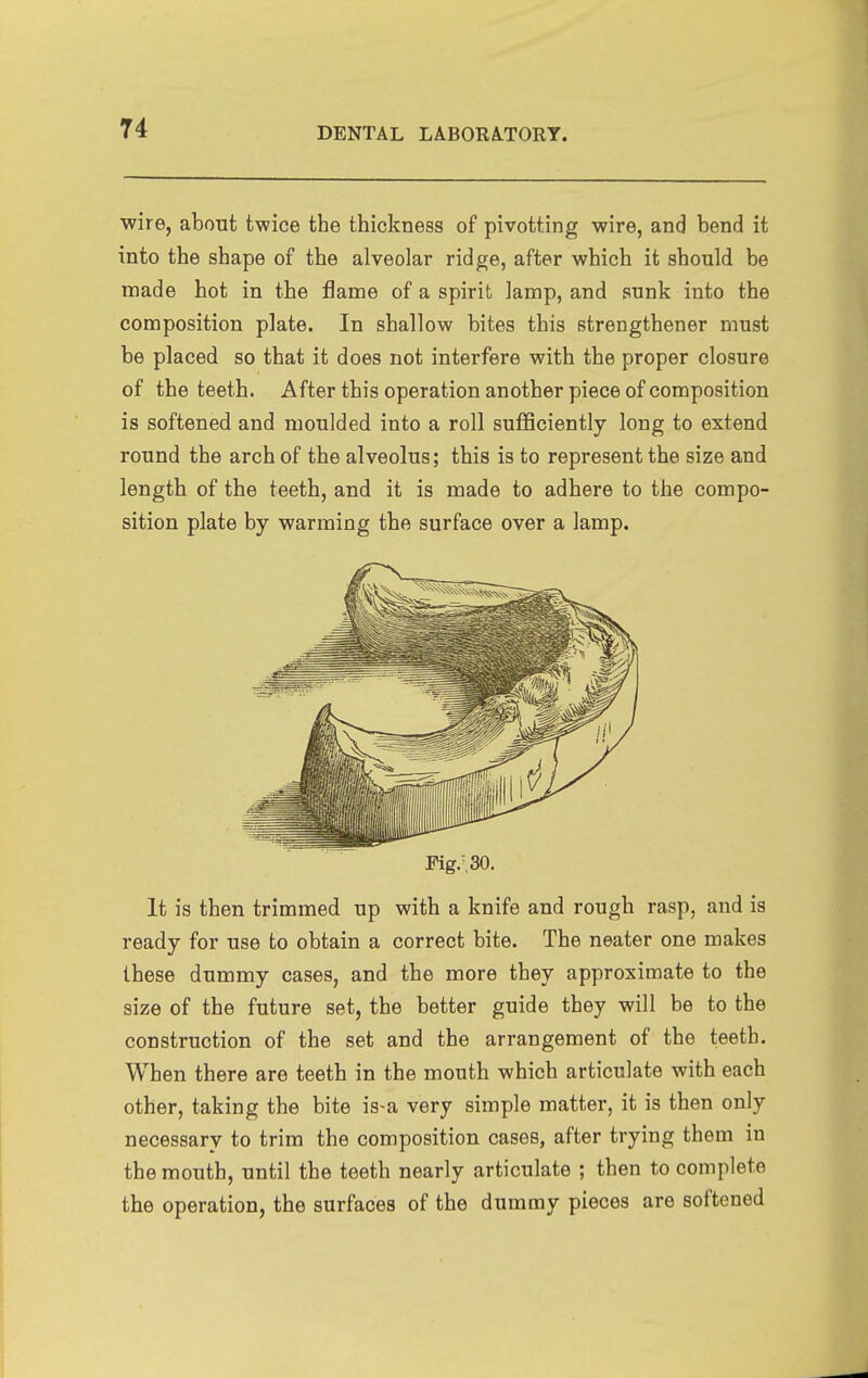 wire, about twice the thickness of pivotting wire, and bend it into the shape of the alveolar ridge, after which it should be made hot in the flame of a spirit lamp, and sunk into the composition plate. In shallow bites this strengthener must be placed so that it does not interfere with the proper closure of the teeth. After this operation another piece of composition is softened and moulded into a roll suflSciently long to extend round the arch of the alveolus; this is to represent the size and length of the teeth, and it is made to adhere to the compo- sition plate by warming the surface over a lamp. Fig.'SO. It is then trimmed up with a knife and rough rasp, and is ready for use to obtain a correct bite. The neater one makes these dummy cases, and the more they approximate to the size of the future set, the better guide they will be to the construction of the set and the arrangement of the teeth. When there are teeth in the mouth which articulate with each other, taking the bite is-a very simple matter, it is then only necessary to trim the composition cases, after trying them in the mouth, until the teeth nearly articulate ; then to complete the operation, the surfaces of the dummy pieces are softened