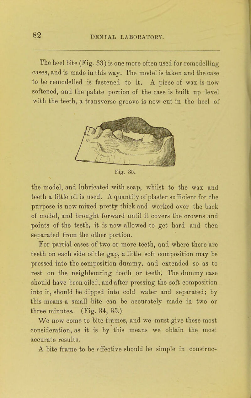 The heel bite (Fig. 33) is one more often used for remodelling cases, and is made in this way. The model is taken and the case to be remodelled is fastened to it. A piece of wax is now softened, and the palate portion of the case is built up level with the teeth, a transverse groove is now cut in the heel of Fig. 35. the model, and lubricated with soap, whilst to the wax and teeth a little oil is used. A quantity of plaster sufficient for the purpose is now mixed pretty thick and worked over the back of model, and brought forward until it covers the crowns and points of the teeth, it is now allowed to get hard and then separated from the other portion. For partial cases of two or more teeth, and where there are teeth on each side of the gap, a little soft composition may be pressed into the composition dummy, and extended so as to rest on the neighbouring tooth or teeth. The dummy case should have been oiled, and after pressing the soft composition into it, should be dipped into cold water and separated; by this means a small bite can be accurately made in two or three minutes. (Fig. 34, 35.) We now come to bite frames, and we must give these most consideration, as it is by this means we obtain the most accurate results. A bite frame to be effective should be simple in construe-