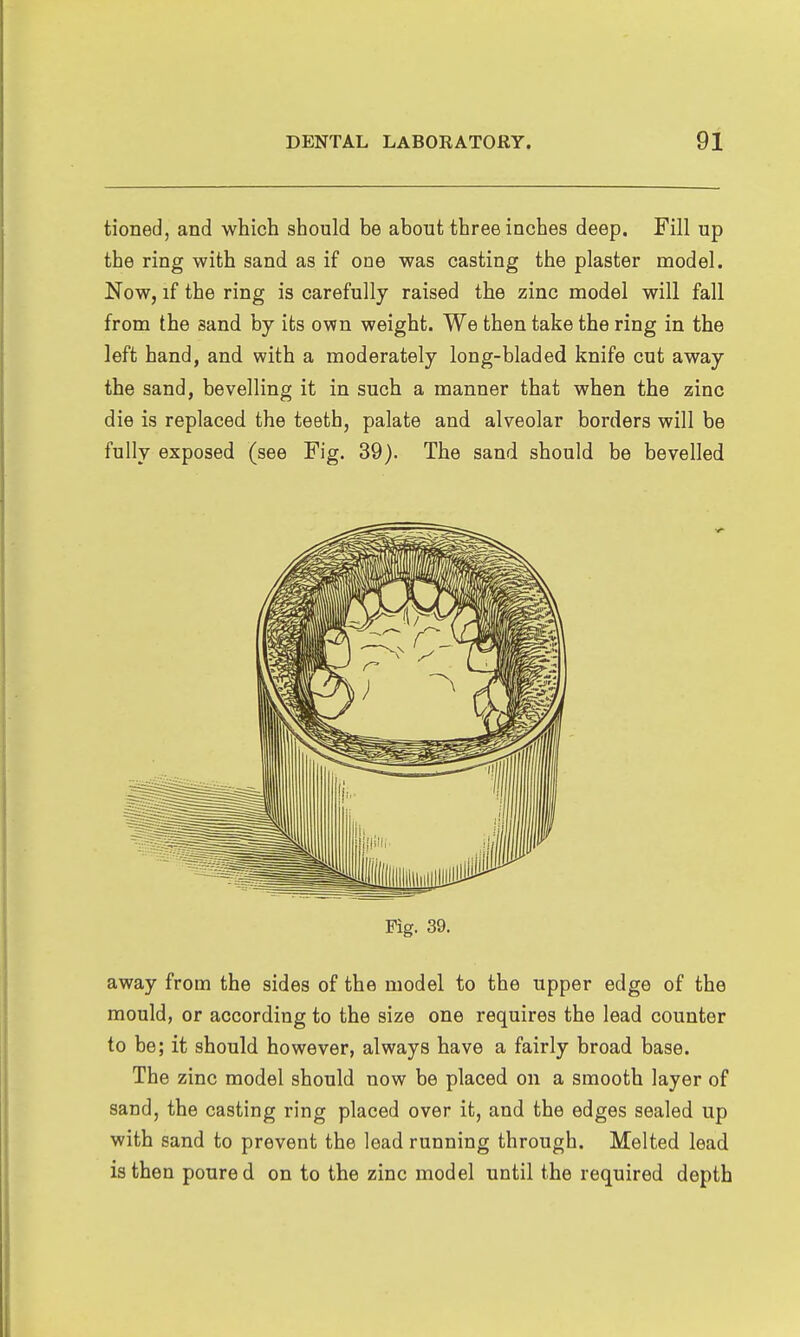 tioned, and which should be about three inches deep. Fill up the ring with sand as if one was casting the plaster model. Now, if the ring is carefully raised the zinc model will fall from the sand by its own weight. We then take the ring in the left hand, and with a moderately long-bladed knife cut away the sand, bevelling it in such a manner that when the zinc die is replaced the teeth, palate and alveolar borders will be fully exposed (see Fig. 39). The sand should be bevelled Fig. 39. away from the sides of the model to the upper edge of the mould, or according to the size one requires the lead counter to be; it should however, always have a fairly broad base. The zinc model should now be placed on a smooth layer of sand, the casting ring placed over it, and the edges sealed up with sand to prevent the lead running through. Melted lead is then poure d on to the zinc model until the required depth