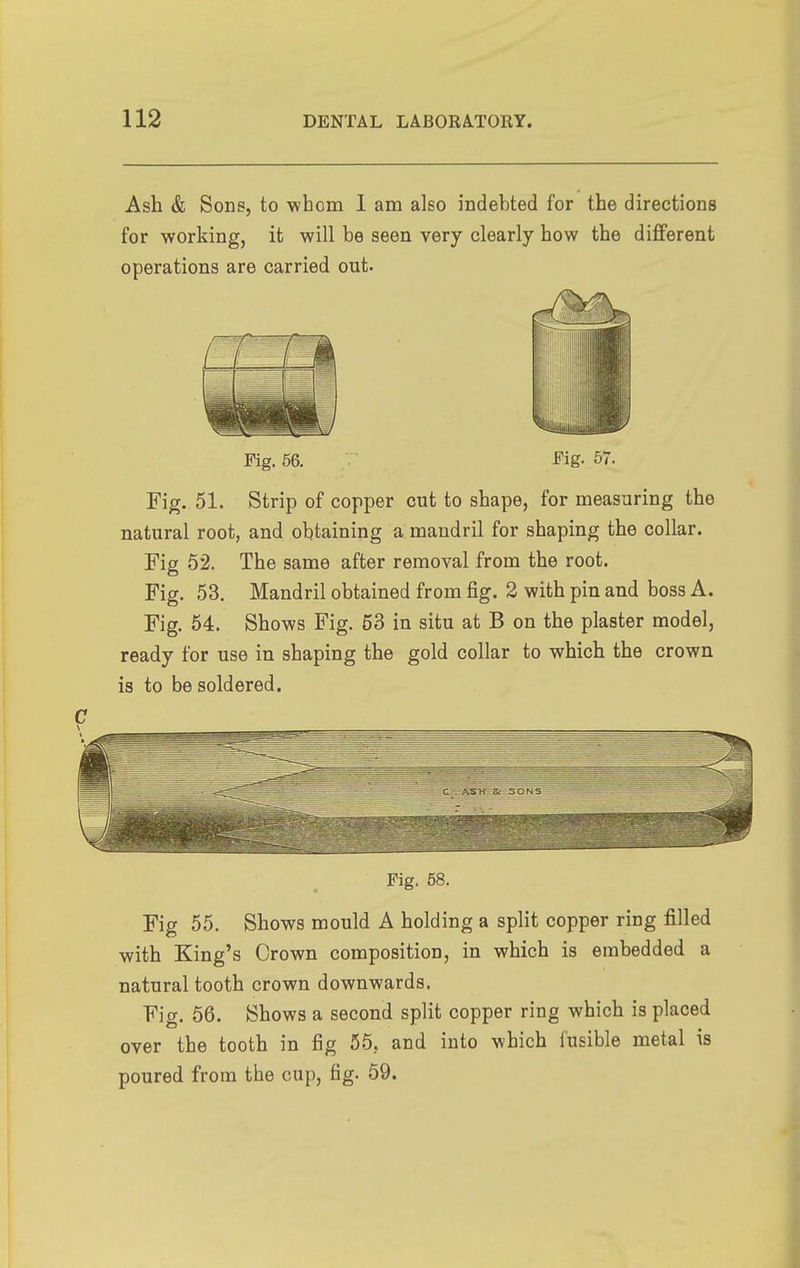 Ash & Sons, to -whom I am also indebted for the directions for working, it will be seen very clearly how the different operations are carried out. Fig. 56. Fig. 57. Fig. 51. Strip of copper cut to shape, for measuring the natural root, and obtaining a mandril for shaping the collar. Fig 52. The same after removal from the root. Fig. 53. Mandril obtained from fig. 2 with pin and boss A. Fig. 54. Shows Fig. 53 in situ at B on the plaster model, ready for use in shaping the gold collar to which the crown is to be soldered. Fig. 58. Fig 55. Shows mould A holding a split copper ring filled with King's Crown composition, in which is embedded a natural tooth crown downwards. Fig. 66. Shows a second split copper ring which is placed over the tooth in fig 55, and into which fusible metal is poured from the cup, fig. 59.