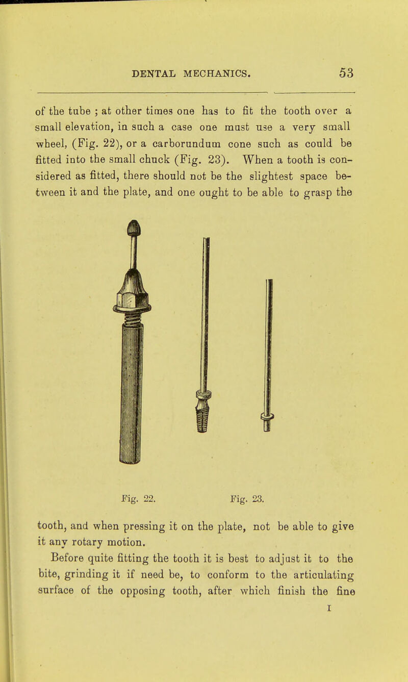 of the tube ; at other times oae has to fit the tooth over a small elevation, in such a case one must use a very small wheel, (Fig. 22) , or a carborundum cone such as could be fitted into the small chuck (Fig. 23). When a tooth is con- sidered as fitted, there should not be the slightest space be- tween it and the plate, and one ought to be able to grasp the Fig. 22. Fig. 23. tooth, and when pressing it on the plate, not be able to give it any rotary motion. Before quite fitting the tooth it is best to adjust it to the bite, grinding it if need be, to conform to the articulating surface of the opposing tooth, after which finish the fine I