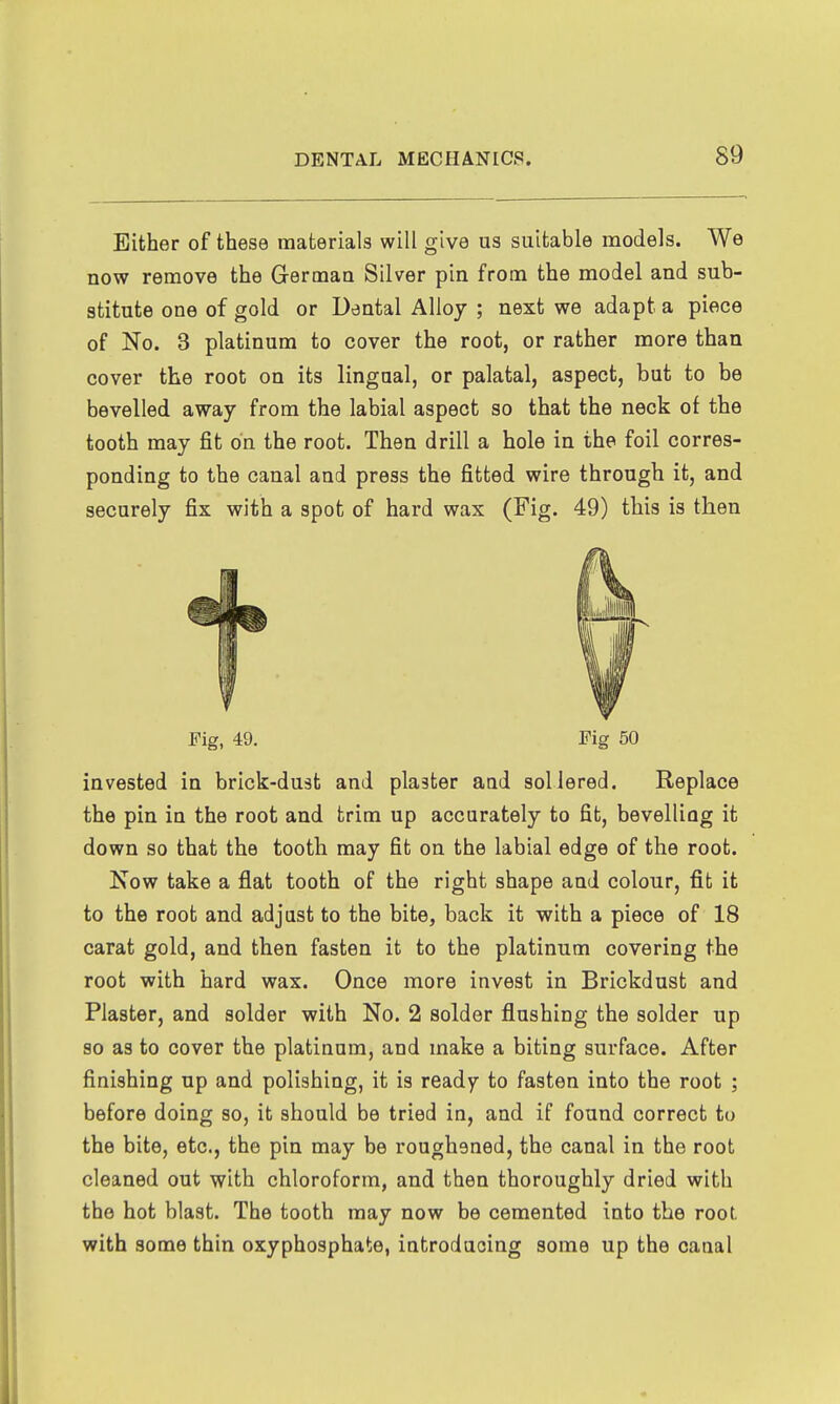 Either of these materials will give us suitable models. We now remove the German Silver pin from the model and sub- stitute one of gold or Dental Alloy ; next we adapt a piece of No. 3 platinum to cover the root, or rather more than cover the root on its lingual, or palatal, aspect, but to be bevelled away from the labial aspect so that the neck of the tooth may fit on the root. Then drill a hole in the foil corres- ponding to the canal and press the fitted wire through it, and securely fix with a spot of hard wax (Fig. 49) this is then Fig, 49. Fig 50 invested in brick-dust and plaster aud soliered. Replace the pin in the root and trim up accurately to fit, bevelliag it down so that the tooth may fit on the labial edge of the root. Kow take a flat tooth of the right shape and colour, fit it to the root and adjust to the bite, back it with a piece of 18 carat gold, and then fasten it to the platinum covering the root with hard wax. Once more invest in Brickdust and Plaster, and solder with No. 2 solder flushing the solder up so as to cover the platinum, and make a biting surface. After finishing up and polishing, it is ready to fasten into the root ; before doing so, it should be tried in, and if found correct to the bite, etc., the pin may be roughened, the canal in the root cleaned out with chloroform, and then thoroughly dried with the hot blast. The tooth may now be cemented into the root with some thin oxyphosphate, introducing some up the canal