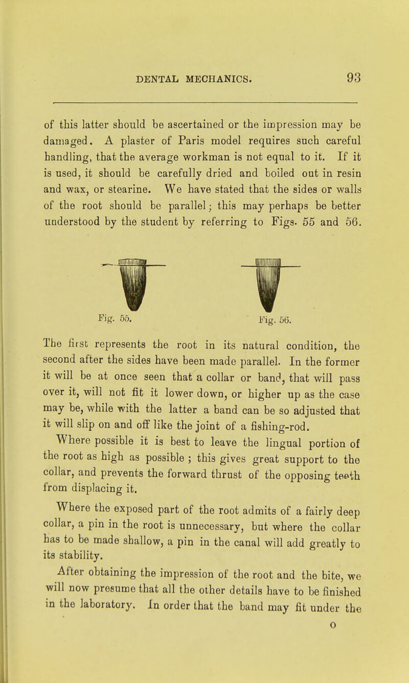 of this latter should be ascertained or the impression may be damaged. A plaster of Paris model requires such careful handling, that the average workman is not equal to it. If it is used, it should be carefully dried and boiled out in resin and wax, or stearine. We have stated that the sides or walla of the root should be parallel; this may perhaps be better understood by the student by referring to Figs. 55 and 66. Fig. 56. it'ig. 5(5. The first represents the root in its natural condition, the second after the sides have been made parallel. In the former it will be at once seen that a collar or band, that will pass over it, will not fit it lower down, or higher up as the case may be, while with the latter a band can be so adjusted that it will slip on and off like the joint of a fishing-rod. Where possible it is best to leave the lingual portion of the root as high as possible ; this gives great support to the collar, and prevents the forward thrust of the opposing teeth from displacing it. Where the exposed part of the root admits of a fairly deep collar, a pin in the root is unnecessary, but where the collar has to be made shallow, a pin in the canal will add greatly to its stability. After obtaining the impression of the root and the bite, we will now presume that all the other details have to be finished in the laboratory. In order that the band may fit under the 0