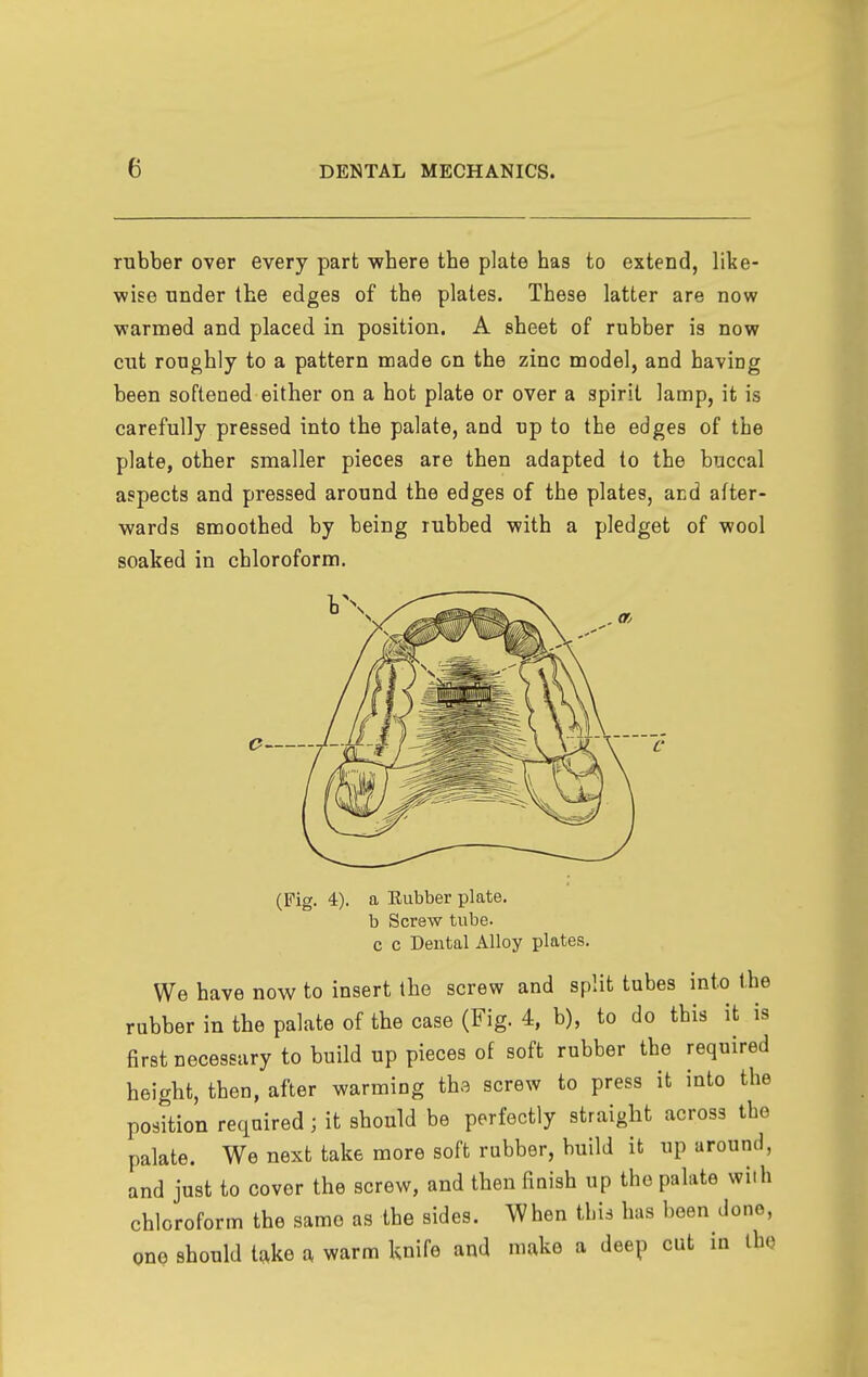 rubber over every part v?here the plate has to extend, like- wise under the edges of the plates. These latter are now warmed and placed in position. A sheet of rubber is now cut roughly to a pattern made on the zinc model, and having been softened either on a hot plate or over a spirit lamp, it is carefully pressed into the palate, and up to the edges of the plate, other smaller pieces are then adapted to the buccal aspects and pressed around the edges of the plates, and after- wards Bmoothed by being rubbed with a pledget of wool soaked in chloroform. o J. (Pig. 4). a Eubber plate. b Screw tube. c c Dental Alloy plates. We have now to insert the screw and split tubes into the rubber in the palate of the case (Fig. 4, b), to do this it is first necessary to build up pieces of soft rubber the required height, then, after warming tha screw to press it into the position required ; it should be perfectly straight across the palate. We next take more soft rubber, build it up around, and just to cover the screw, and then finish up the palate wiih chloroform the same as the sides. When this has been done, one should take a warm knife and make a deep cut in the
