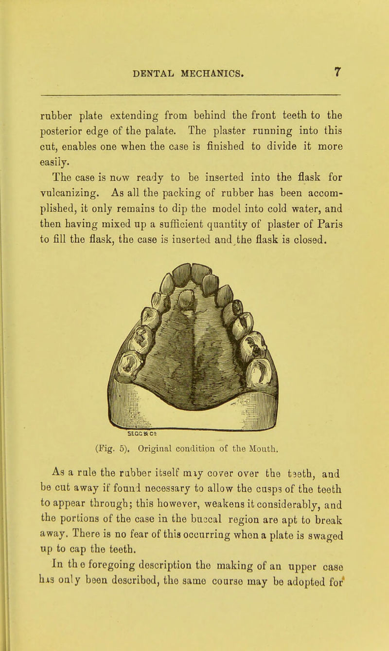 rubber plate extending from behind the front teeth to the posterior edge of the palate. The plaster running into this cut, enables one when the case is finished to divide it more easily. The case is now ready to be inserted into the flask for vulcanizing. As all the packing of rubber has been accom- plished, it only remains to dip the model into cold water, and then having mixed up a sufficient quantity of plaster of Paris to fill the flask, the case is inserted and the flask is closed. (Fig. 5), Original conclitipn of the Mouth. As a rule the rabber itself miy cover over the taeth, and be cut away if found necessary to allow the cusps of the teeth to appear through; this however, weakens it considerably, and the portions of the case in the buccal region are apt to break away. There is no fear of this ocourriag when a plate is swaged up to cap the teeth. In th e foregoing description the making of an upper case hxs only been described, the same course may be adopted for