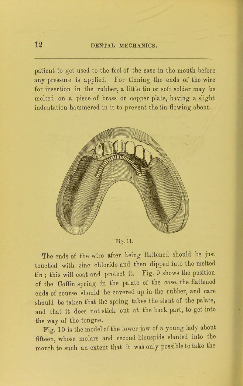 patient to get used to the feel of the case in the mouth before any pressuie is applied. For tinning the ends of the wire for insertion in the rubber, a little tin or soft solder may be melted on a piece of brass or copper plate, having a slight indentation hammered in it to prevent the tin flowing about. The ends of the wire after being flattened should be just touched with zinc chloride and then dipped into the melted tin ; this will coat and protect it. Fig. 9 shows the position of the CoflSn spring in the palate of the case, the flattened ends of course should be covered up in the rubber, and care should be taken that the spring takes the slant of the palate, and that it does not stick out at the back part, to get into the way of the tongue. Fig. 10 is the model of the lower jaw of a young lady about fifteen, whose molars and second bicuspids slanted into the mouth to such an extent that it was only possible to take the