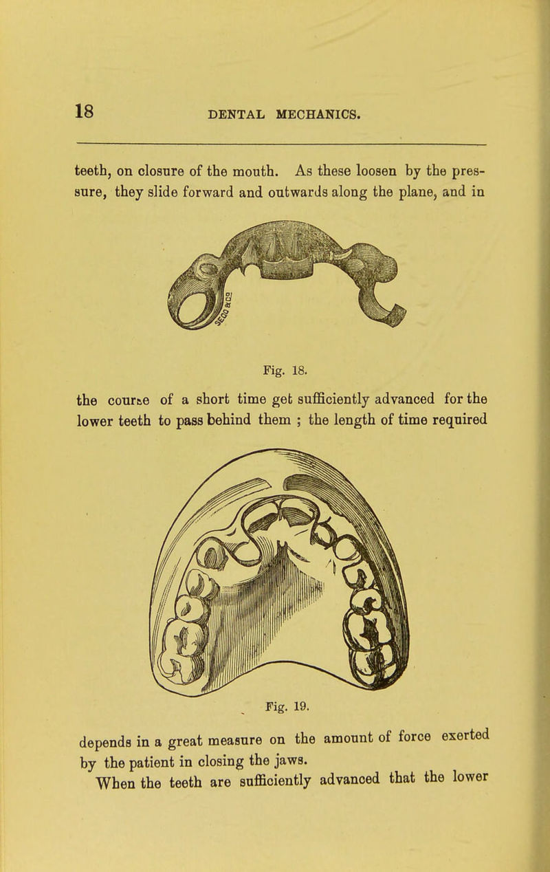 teeth, on closure of the mouth. As these loosen by the pres- sure, they slide forward and outwards along the plane, and in Fig. 18. the cour&e of a short time get sufficiently advanced for the lower teeth to pass behind them ; the length of time required Fig. 19. depends in a great measure on the amount of force exerted by the patient in closing the jaws. When the teeth are sufficiently advanced that the lower