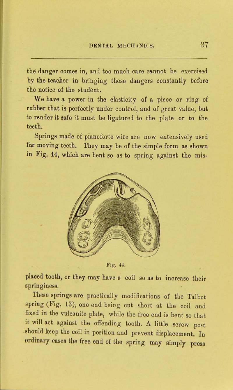 the danger comes in, and too much care cannot be exercised by the teacier in bringing these dangers constantly before the notice of the student. We have a power in the elasticity of a piece or ring of rubber that is perfectly under control, and of great value, but to render it safe it must be ligatured to the plate or to the teeth. Springs made of pianoforte wire are now extensively used for moving teeth. They may be of the simple form as shown m Fig. 44, which are bent so as to spring against the mis- Fig. 4i. placed tooth, or they may have a coil so as to increase their springiness. These springs are practically modifications of the Talbot spring (Fig. 13), one end being cut short at the coil and fixed in the vulcanite plate, while the free end is bent so that it will act against the offending tooth. A little screw pott -should keep the coil in position and prevent displacement. In ordinary cases the free end of the spring may simply press