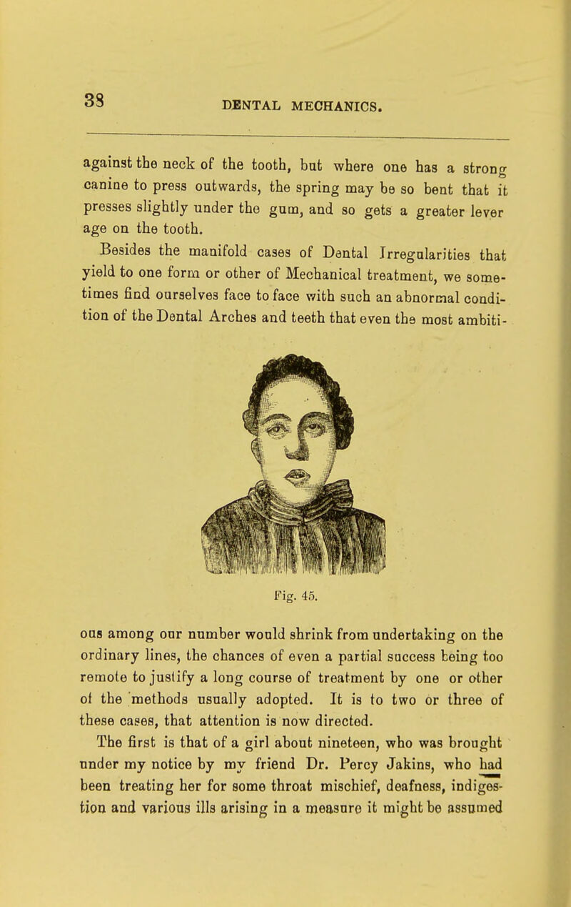 against the neck of the tooth, but where one has a strong canine to press outwards, the spring may be so bent that it presses slightly under the gum, and so gets a greater lever age on the tooth. Besides the manifold cases of Dental Irregularities that yield to one form or other of Mechanical treatment, we some- times find ourselves face to face with such an abnormal condi- tion of the Dental Arches and teeth that even the most ambiti- ous among our number would shrink from undertaking on the ordinary lines, the chances of even a partial success being too remote to justify a long course of treatment by one or other of the methods usually adopted. It is to two or three of these cases, that attention is now directed. The first is that of a girl about nineteen, who was brought under my notice by my friend Dr. Percy Jakins, who had been treating her for some throat mischief, deafness, indiges- tion and various ills arising in a measure it might be assumed