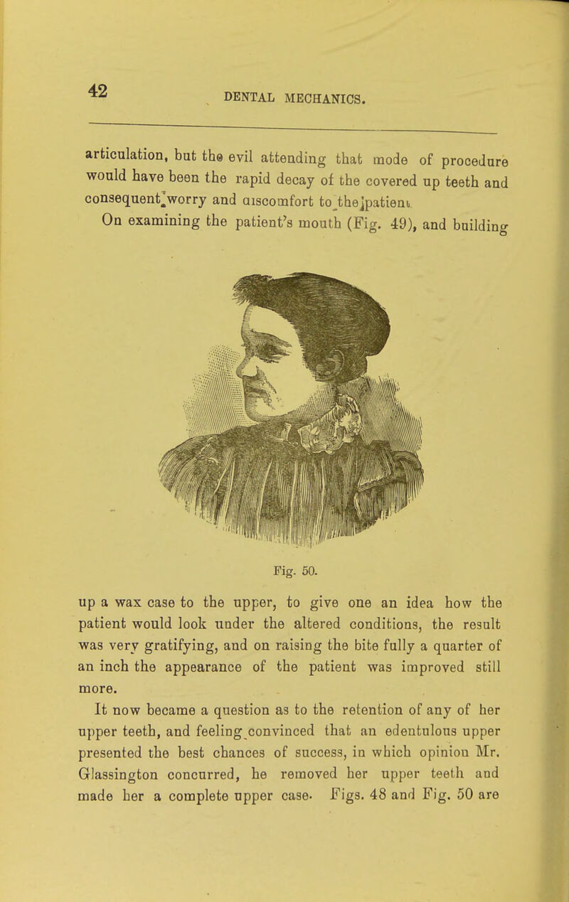 DENTAL MECHANICS. articulation, but the evil atteading that mode of procedure would have been the rapid decay of the covered up teeth and con3equent>orry and aiscomfort tojhejpatieni.. On examining the patient's mouth (Fig. 49), and building Fig. 60. up a wax case to the upper, to give one an idea how the patient would look under the altered conditions, the result was very gratifying, and on raising the bite fully a quarter of an inch the appearance of the patient was improved still more. It now became a question as to the retention of any of her upper teeth, and feeling convinced that an edentulous upper presented the best chances of success, in which opiniou Mr. Glassington concurred, he removed her upper teeth and made her a complete upper case- -Figs. 48 and Fig. 50 are
