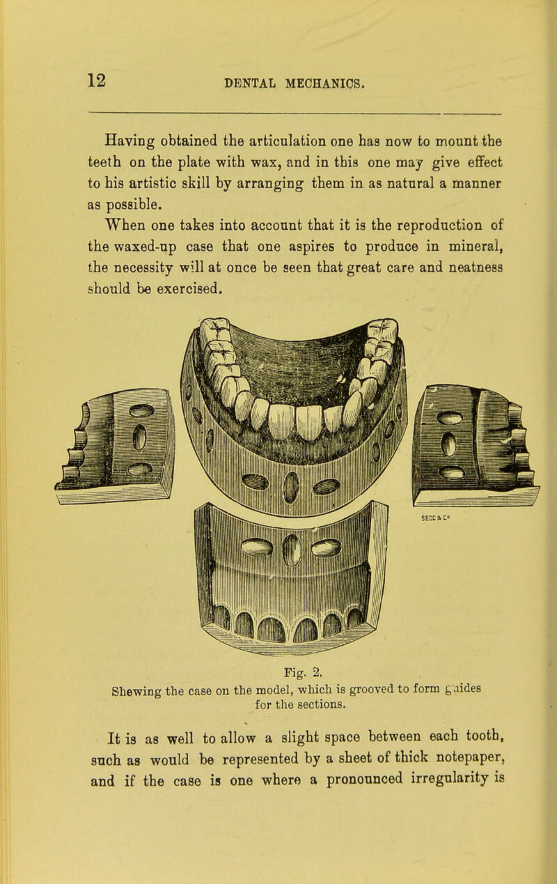 Having obtained the articulation one has now to mount the teeth on the plate with wax, and in this one may give effect to his artistic skill by arranging them in as natural a manner as possible. When one takes into account that it is the reproduction of the waxed-up case that one aspires to produce in mineral, the necessity will at once be seen that great care and neatness should be exercised. Fig. 2. Shewing the case ou the model, which is grooved to form ^aides for the sections. It is as well to allow a slight space between each tooth, such as would be represented by a sheet of thick notepaper, and if the case is one where a pronounced irregularity is