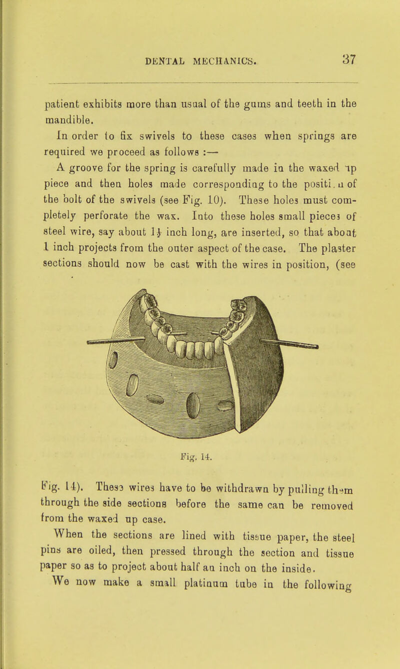 patient exhibits more than usual of the gums and teeth in the mandible. In order to fix swivels to these cases when springs are required we proceed as follows :— A groove for the spring is carefully made in the waxed np piece and then holes made corresponding to the positi.aof the bolt of the swivels (see Fig. 10). These holes must com- pletely perforate the wax. loto these holes small pieces of steel wire, say about I 3 inch long, are inserted, so that aboat .1 inch projects from the outer aspect of the case. The pla3ter sections should now be cast with the wires in position, (see Fig. 14. b'ig. M). Thess wires have to be withdrawn by pulling th-^m th rough the side sections before the same can be removed from the waxed up case. When the sections are lined with tissue paper, the steel pins are oiled, then pressed through the section and tissue paper so as to project about half an inch on the inside. We now make a small platinum tube in the following