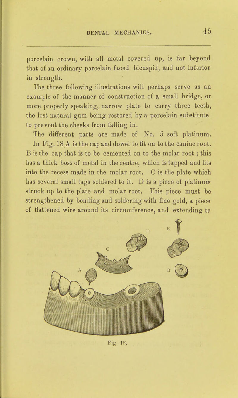 porcelaiu crown, with all metal covered up, is far beyond that of an ordinary porcelain ficed bicuspid, and not inferior in strength. The three following illustrations will perhaps serve as an example of the manner of construction of a small bridge, or more properly speaking, narrow plate to carry three teeth, the lost natural gum being restored by a porcelain substitute to prevent the cheeks from falling in. The different parts are made of No. 5 soft platinum. In Fig. 18 A is the cap and dowel to fit on to the canine root. B is the cap that is to be cemented on to the molar root ; this has a thick boss of metal in the centre, which is tapped and fits into the recess made in the molar root. C is the plate which has several small tags soldered to it. D is a piece of platinunr struck up to the plate and molar root. This piece must be strengthened by bending and soldering with fine gold, a piece of flattened wire around its circumference, and extending tc