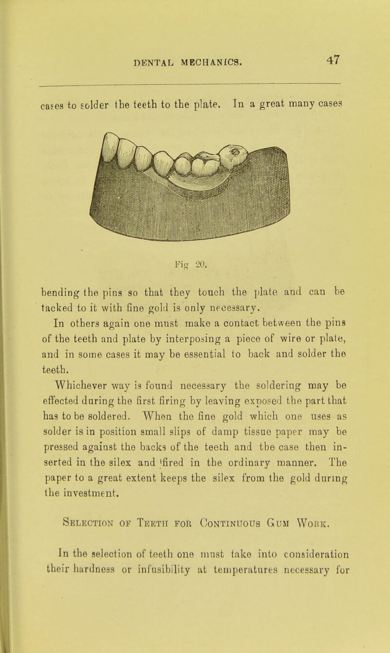 cases to solder the teeth to the plate. In a great many cases Fig -20. bending the pins so that they touch the i)late and can be tacked to it with fine gold is only necessary. In others again one must make a contact between the pins of the teeth and plate by interposing a piece of wire or plale, and in some cases it may be essential to back and solder the teeth. Whichever way is found necessary the soldering may be effected during the first firing by leaving exposed the part that has to be soldered. When the fine gold which one uses as solder is in position small slips of damp tissue paper may be pressed against the backs of the teeth and the case then in- serted in the silex and 'fired in the ordinary manner. The paper to a great extent keeps the silex from the gold during the investment. Selection of Teeth for Continuous Gum Wouk. In the selection of teeth one must take into consideration their hardness or infusibility at temperatures necessary for