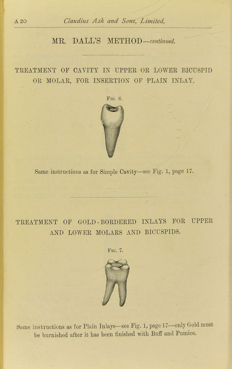 ME. BALL'S METHOD— TREATMENT OP CAVITY IN UPPER OR LOWER BICUSPID OR MOLAR, FOR INSERTION OF PLAIN INLAY. Fig. 6. Same instructions as for Simple Cavity—see Fig. 1, page 17. TREATMENT OF GOLD - BORDERED INLAYS FOR UPPER AND LOWER MOLARS AND BICUSPIDS. Fig. 7. 8ame instructions as for Plain Inlays—see Fig. 1, page 17—only Gold must be burnished after it lias been finished with Buff and Pumice.