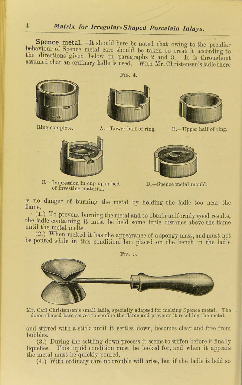 Spence metal.—It should here be noted that owing to the peculiar behaviour of Spence metal care should be taken to treat it according to the directions given below in paragraphs 2 and 3. It is throughout assumed that an ordinary ladle is used. With Mr. Christensen's ladle there Fig. 4. Bing complete. A.—Lower half of ring. B.—Upper half of ring. ^•~I™pression in cup upon bed D.—Spence metal mould, of investing material. IS no danger of burning the metal by holding the ladle too near the flame. ' (1.) To prevent burning the metal and to obtain uniformly good results, the ladle containing it must be held some little distance above the flame until the metal melts. (2.) When melted it has the appearance of a spongy mass, and must not be poured while in this condition, but placed on the bench in the ladle Fig. 5. Mr. Carl Christensen's small ladle, specially adapted for melting Spence metal. The dome-shaped base serves to confine the flame and prevents it reaching the metal. and stirred with a stick until it settles down, becomes clear and free from bubbles. (3.) During the settling down process it seems to stiffen before it finally liquefies. This liquid condition must be looked for, and when it appeal's the metal must be quickly poured.