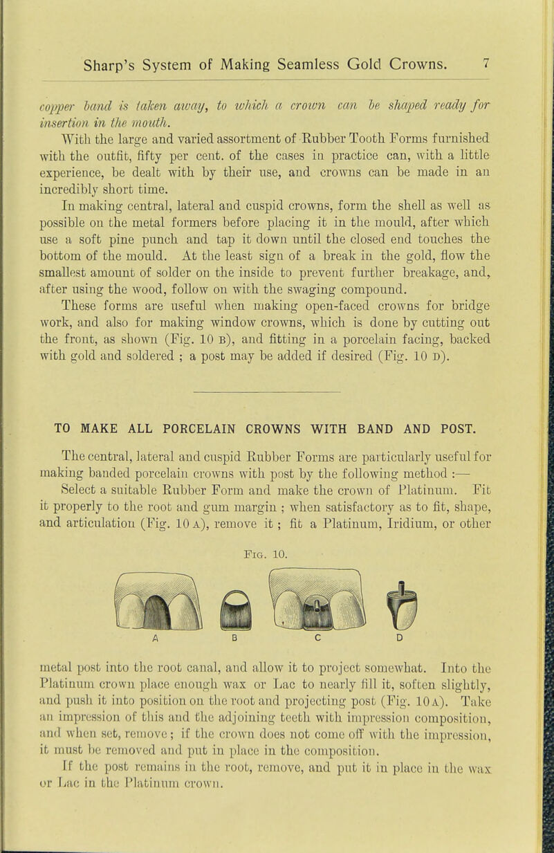 copp&r hand is iaken aivay, to ivhich a croion can he shaped ready for insertion in the mouth. With the large and varied assortment of Eubber Tooth Forms furnished with the outfit, fifty per cent, of the cases ia practice can, with a little experience, be dealt with by their use, and crowns can be made in an incredibly short time. In making- central, lateral and cuspid crowns, form the shell as well as possible on the metal formers before placing it in the mould, after which use a soft pine punch and tap it down until the closed end touches the bottom of the mould. At the least sign of a break in the gold, flow the smallest amount of solder on the inside to prevent further breakage, and^ after using the wood, follow on with the swaging compound. These forms are useful when making open-faced crowns for bridge work, and also for making window crowns, which is done by cutting out the front, as shown (Fig. 10 b), and fitting in a porcelain facing, backed with gold and soldered ; a post may be added if desired (Fig. 10 d). TO MAKE ALL PORCELAIN CROWNS WITH BAND AND POST. The central, lateral and cuspid Rubber Forms are particularly useful for making banded porcelain crowns with post by the following method :— Select a suitable Rubber Form and make the crown of Platinum. Fit it properly to the root and gum margin ; when satisfactory as to fit, shape, and articulation (Fig. 10 a), remove it; fit a Platinum, Iridium, or other Fig. 10. A B c D metal post into the root canal, and allow it to project somewhat. Into the Platinum crown place enough wax or Lac to nearly fill it, soften slightly, and push it into position on the root and projecting post (Fig. 10 A). Take ail impression of this and the adjoining teeth with impression composition, imd when set, remove; if the crown does not come off with the impression, it must be removed and put in place in the composition. If the post remiiins in the root, remove, and put it in place in the wax or Lac in the i'latinum crown.