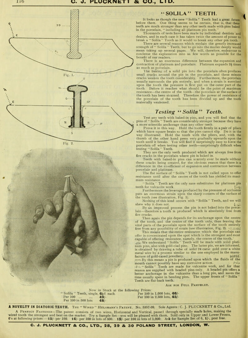 lib Fis. 2. SOLILA TEETH. It looks as though the new  Solila '' Teeth had a great future before them. One thing seems to be certain, that is, that these teeth are much stronger than any other teeth made with pins baked in the porcelain,  including all platinum pin teeth. Thousands of tests have been made by individual dentists and dealers, and in each case it has taken twice the amount of power to break a  Solila  Tooth as it would to break any other pin tooth. There are several reasons which explain the greatly increased strength of  Solila  Teeth, but to go into the matter deeply would mean taking up several pages. We will, therefore, endeavour to condense the explanation into as few words as possible for the benefit of our readers. There is an enormous difference between the expansion and contraction of platinum and porcelain. Platinum expands 2^ times as much as porcelain. The baking of a solid pin into the porcelain often produces small cracks around the pin in the porcelain, and these minute cracks weaken the tooth considerably. Furthermore, the porcelain usually surrounds the pin entirely, and when a strain is exercised upon the tooth the pressure is first put on the outer part of the tooth Before it reaches what should be the point of maximum resistance—the centre of the tooth — the porcelam at the surface of the tooth has been strained. Therefore the power of resistance of the porcelain of the tooth has been divided up and the tooth materially weakened. Testing ''Solila'' Teeth. Test any teeth with baked-in pins, and you will find that the pins of  Solila Teeth are considerably stronger because they have a more scientific anchorage than any other teeth. Prove it in this way. Hold the tooth firmly in a pair of pliers which have square beaks so that the pins cannot slip. Do it in the way illustrated. Hold the tooth with the pliers, and, v/ith the thumb of the other hand press very gradually upwards upon the tooth until it breaks. You will find it surprisingly easy to force the porcelain off when testing other teeth—surprisingly difficult when testing  Solila Teeth. They are the only teeth produced which are always free from fire cracks in the porcelain where pin is baked in. Teeth with baked-in pins can scarcely ever be made without these cracks being created, for the obvious reason that there is a difference in the co-efficient of expansion and contraction between porcelain and platinum. The flat surface of  Solila Teeth is not called upon to offer resistance until after the centre of the tooth has yielded its maxi- mum resistance ■' Solila  Teeth are the only sane substitutes for platinum pin teeth for vulcanite work. c:^! Furthermore the leverage produced by the pressure of occlusion puts an enormous strain upon the sharp corners of the surface of the tooth (see illustration. Fig. 1). Nothing of this kind occurs with Solila Teeth, and we will shew why it does not. ^-z^i By an improved process the pin is not baked into the porce- lain—therefore a tooth is produced which is absolutely free from fire cracks. Then again the pin depends for its anchorage upon the centre of the tooth, and the centre of the tooth only, thus leaving the vital parts of the porcelain upon the surface of the tooth entirely free from any possibility of strain (see illustration. Fig. 2). -DjeASi This means that the entire resistance which the porcelain can offer is concentrated upon the spot which is the strongest and most capable of offering resistance, namely, the centre of the tooth.* ^),.iWe understand  Solila  Teeth will be made with solid plati- nurn pins, also with gold-clad pins. The latter pin, we are informed, is obtained by drawing a tube of solid 24 carat gold over a white metal wire by a process similar to the one employed in the manu- facture of gold-cased jewellery. tsi^SS.i;] i(Jr3fD.,By this means a pin is produced upon which the fluids of the mouth cannot possibly have any corrosive action. p-c\-^ 2:.^ Solila Teeth are made for vulcanite work, and for that reason are supplied with headed pins only. A headed pin offers a better anchorage in the vulcanite than a long pin, and saves the time usually spent in bending pins. The upper fronts of  Solila  Teeth are flat-back teeth. Ask for Full Pamphlet. Teeth, ' Solila  Per 100 Per 100 in 500 lots Now single n Stock at the following Prices: 6^d each. Per 100 in 1,000 lots, 46/- 49/- Per 100 in 2,500 lots, 45/- 48/ A NOVELTY IN DIATORIC TEETH. The  Wired  Hdlsmann's Patent. No. 5357-09. Sole Agents: C. J. PLUCKNETT & Co., Ltd. A Perfect Fastener—The patent consists of two wires, Horizontal and Vertical, passed through specially made holes, making the wired tooth the strongest and best on the market. Try a Sample Set—you will be pleased with them. Sold only in Upper and Lower Fronts. 6's at following prices:—15/- per 100. 14/- per 100 in lots of 500. 13/- per 100 in lots of 1,000. Ask for Sample Set of 6, 1/-, post free.