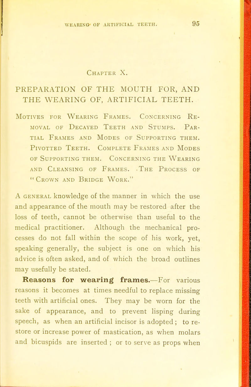 Chapter X. PREPARATION OF THE MOUTH FOR, AND THE WEARING OF, ARTIFICIAL TEETH. Motives for Wearing Frames. Concerning Re- moval of Decayed Teeth and Stumps. Par- tial Frames and Modes of Supporting them. Pivotted Teeth. Complete Frames and Modes of Supporting them. Concerning the Wearing and Cleansing of Frames. -The Process of  Crown and Bridge Work. A general knowledge of the manner in which the use and appearance of the mouth may be restored after the loss of teeth, cannot be otherwise than useful to the medical practitioner. Although the mechanical pro- cesses do not fall within the scope of his work, yet, speaking generally, the subject is one on which his advice is often asked, and of which the broad outlines may usefully be stated. Reasons for wearing frames.—For various reasons it becomes at times needful to replace missing teeth with artificial ones. They may be worn for the sake of appearance, and to prevent lisping during speech, as when an artificial incisor is adopted ; to re- store or increase power of mastication, as when molars and bicuspids are inserted ; or to serve as props when