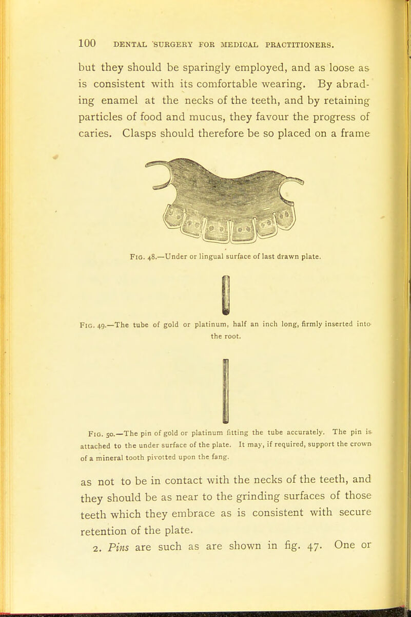but they should be sparingly employed, and as loose as is consistent with its comfortable wearing. By abrad- ing enamel at the necks of the teeth, and by retaining particles of food and mucus, they favour the progress of caries. Clasps should therefore be so placed on a frame Fig. 48.—Under or lingual surface of last drawn plate. 8 Fig. 49.—The tube of gold or platinum, half an inch long, firmly inserted into the root. Fig. 50. The pin of gold or platinum fitting the tube accurately. The pin is attached to the under surface of the plate. It may, if required, support the crown of a mineral tooth pivotted upon the fang. as not to be in contact with the necks of the teeth, and they should be as near to the grinding surfaces of those teeth which they embrace as is consistent with secure retention of the plate. 2. Pins are such as are shown in fig. 47. One or