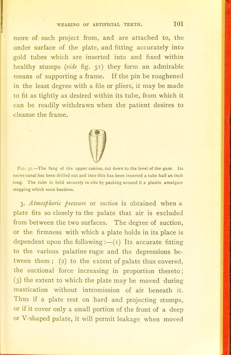 more of such project from, and are attached to, the under surface of the plate, and fitting accurately into gold tubes which are inserted into and fixed within healthy stumps (vide fig. 51) they form an admirable means of supporting a frame. If the pin be roughened in the least degree with a file or pliers, it may be made to fit as tightly as desired within its tube, from which it can be readily withdrawn when the patient desires to cleanse the frame. Fig. 51.—The fang of the upper canine, cut down to the level of the gum. Its nerve canal has been drilled out and into this has been inserted a tube half an inch long. The tube is held securely in situ by packing around it a plastic amalgam stopping which soon hardens. 3. Atmospheric pressure or suction is obtained when a plate fits so closely to the palate that air is excluded from between the two surfaces. The degree of suction, or the firmness with which a plate holds in its place is dependent upon the following :—(1) Its accurate fitting to the various palatine rugte and the depressions be- tween them; (2) to the extent of palate thus covered, the suctional force increasing in proportion thereto; (3) the extent to which the plate may be moved during mastication without intromission of air beneath it. Thus if a plate rest on hard and projecting stumps, or if it cover only a small portion of the front of a deep or V-shaped palate, it will permit leakage when moved