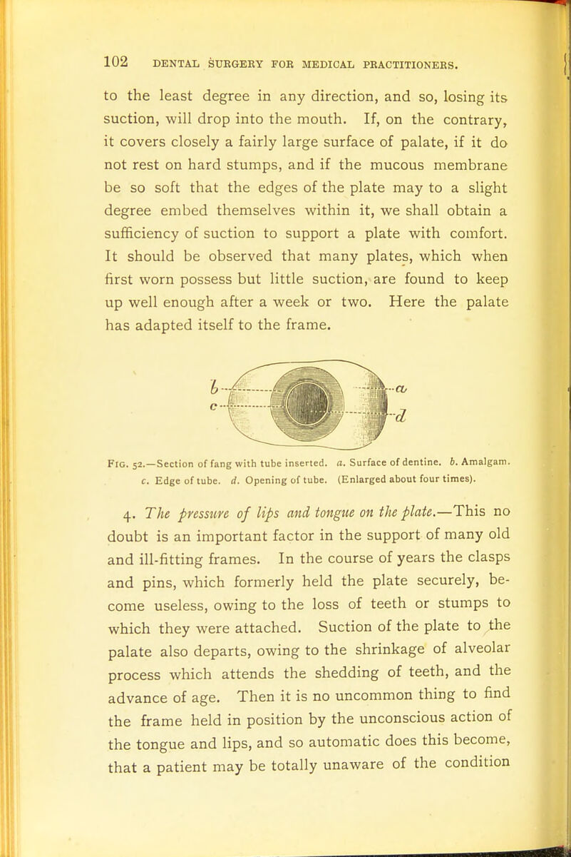 to the least degree in any direction, and so, losing its suction, will drop into the mouth. If, on the contrary, it covers closely a fairly large surface of palate, if it do not rest on hard stumps, and if the mucous membrane be so soft that the edges of the plate may to a slight degree embed themselves within it, we shall obtain a sufficiency of suction to support a plate with comfort. It should be observed that many plates, which when first worn possess but little suction, are found to keep up well enough after a week or two. Here the palate has adapted itself to the frame. Fig. 52.—Section of fang with tube inserted, a. Surface of dentine. 6. Amalgam. c. Edge of tube. d. Opening of tube. (Enlarged about four times). 4. The pressure of lips and tongue on the plate.—This no doubt is an important factor in the support of many old and ill-fitting frames. In the course of years the clasps and pins, which formerly held the plate securely, be- come useless, owing to the loss of teeth or stumps to which they were attached. Suction of the plate to the palate also departs, owing to the shrinkage of alveolar process which attends the shedding of teeth, and the advance of age. Then it is no uncommon thing to find the frame held in position by the unconscious action of the tongue and lips, and so automatic does this become, that a patient may be totally unaware of the condition
