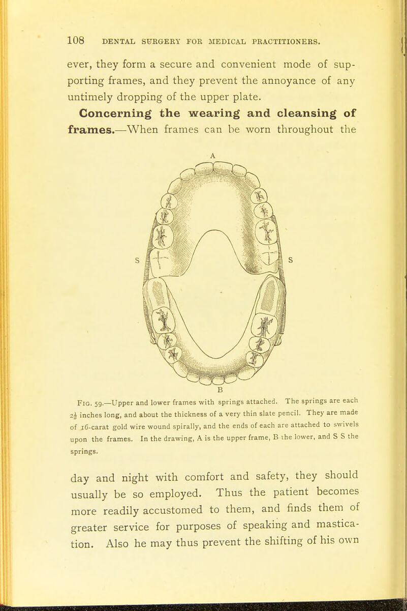 ever, they form a secure and convenient mode of sup- porting frames, and they prevent the annoyance of any untimely dropping of the upper plate. Concerning the wearing and cleansing of frames.—When frames can he worn throughout the Fig. 59.—Upper and lower frames with springs attached. The springs are each 2* inches long, and about the thickness of a very thin slate pencil. They are made of iC-carat gold wire wound spirally, and the ends of each are attached to swivels upon the frames. In the drawing, A is the upper frame, B the lower, and S S the springs. day and night with comfort and safety, they should usually be so employed. Thus the patient becomes more readily accustomed to them, and finds them of greater service for purposes of speaking and mastica- tion. Also he may thus prevent the shifting of his own