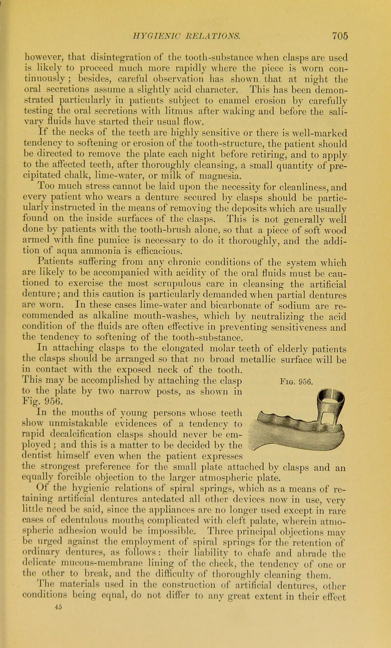 however, that disintegration of the tooth-substance Avhen clasps are used is likely to proceed much more rapidly where the piece is worn con- tinuously ; besides, careful observation has sliown that at night the oral secretions assume a slightly acid character. This has been demon- strated particularly in patients subject to enamel erosion by carefully testing the oral secretions with litmus after waking and before the sali- vary fluids have started their usual flow. If the necks of the teeth are highly sensitive or there is well-marked tendency to softening or erosion of the tooth-structure, the patient should be directed to remove the plate each night before retiring, and to apply to the affected teeth, after thoroughly cleansing, a small quantity of pre- cipitated chalk, lime-water, or milk of magnesia. Too much stress cannot be laid upon the necessity for cleanliness, and every patient who wears a denture secured by clasps should be partic- ularly instructed in the means of removing the deposits which are usually found on the inside surfaces of the clasps. This is not generally well done by patients with the tooth-brush alone, so that a piece of soft wood armed with fine pumice is necessary to do it thoroughly, and the addi- tion of aqua ammonia is efficacious. Patients suffering from any chronic conditions of the system which are likely to be accompanied with acidity of the oral fluids must be cau- tioned to exercise the most scrupulous care in cleansing the artificial denture; and this caution is particulai'ly demanded when partial dentures are worn. In these cases lime-water and bicarbonate of sodium are re- commended as alkaline mouth-washes, which by neutralizing the acid condition of the fluids are often effective in preventing sensitiveness and the tendency to softening of the tooth-substance. In attaching clasps to the elongated molar teeth of elderly patients the clasps should be arranged so that no broad metallic surface will be in contact with the exposed neck of the tooth. This may be accomplished by attaching the clasp Fig. 956. to the plate by two narrow posts, as shown in Fig. 956. In the mouths of young ^^ersons whose teeth show unmistakable evidences of a tendency to rapid decalcification clasps should never be em- ployed ; and this is a matter to be decided by the dentist himself even when the patient expresses the strongest preference for the small plate attached by clasps and an equally forcible objection to the larger atmospheric plate. Of the hygienic relations of spiral springs, which as a means of re- taining artificial dentures antedated all other devices now in use, xeiy little need be said, since the appliances are no longer used except in rare cases of edentulous mouthg complicated with cleft palate, wherein atmo- spheric adhesion would be impossible. Three principal objections mav be urged against the employment of spiral springs for tlie retention of ordinary dentures, as follows: tlieir liability to chafe and abrade the delicate mucous-membrane lining of the clieek, the tendency of one or the other to break, and the difficulty of thorouglily cleaning them. The materials used in the construction of artificial dentures, other conditions being eqnal, do not diff'er to any great extent in their efi'ect 45