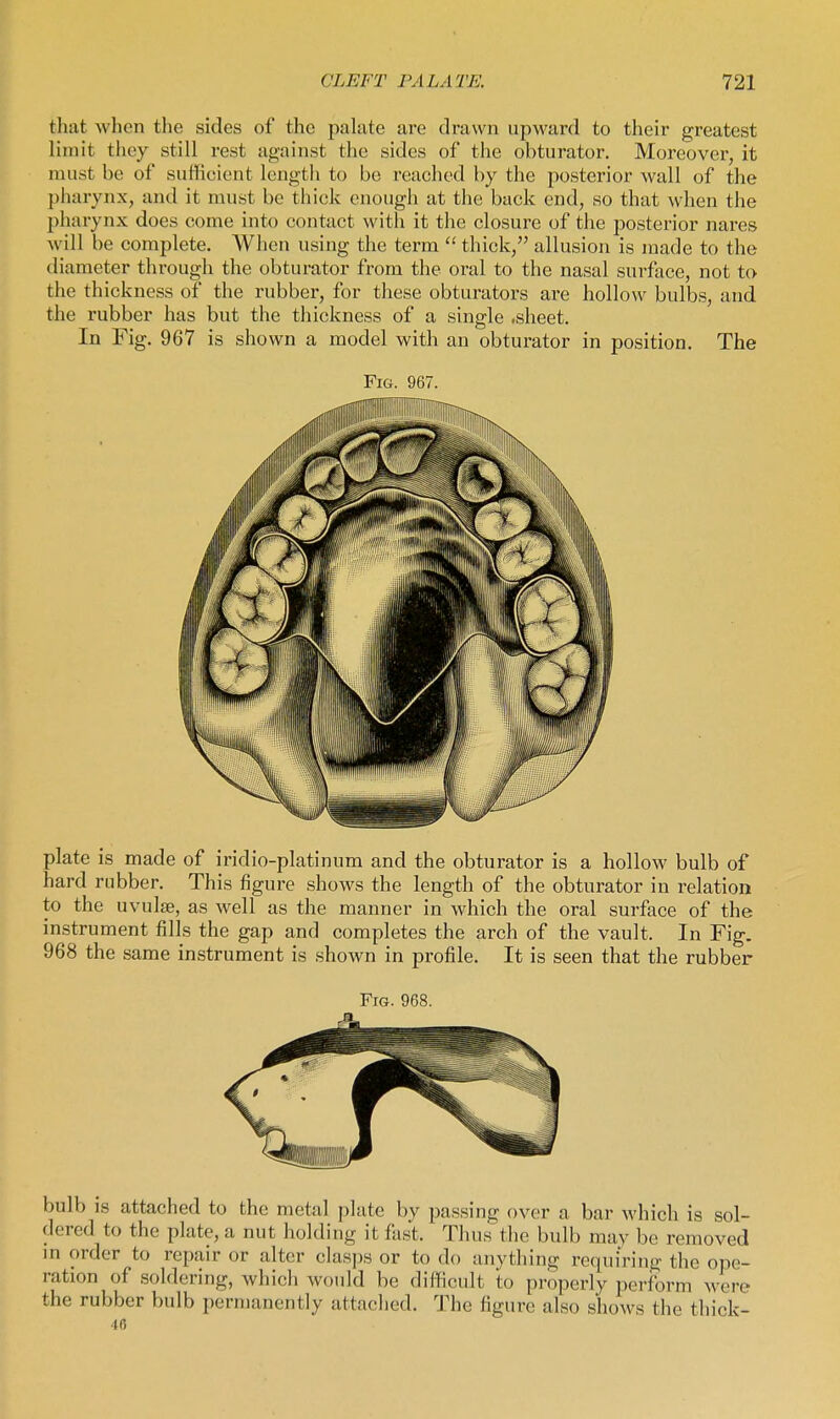 that when the sides of the pakite are drawn upward to their greatest limit they still rest against the sides of the obtui-ator. Moreover, it must be of sufficient length to be reached by the posterior wall of the pharynx, and it must be thick enough at the back end, so that when the pharynx does come into contact with it the closure of the jDOsterior nares will be complete. When using the term  thick, allusion is made to the diameter through the obturator from the oral to the nasal surface, not to the thickness of the rubber, for these obturators are hollow bulbs, and the rubber has but the thickness of a single .sheet. In Fig. 967 is shown a model with an obturator in position. The Fig. 967. plate is made of iridio-platinum and the obturator is a hollow bulb of hard rubber. This figure shows the length of the obturator in relation to the uvulae, as well as the manner in which the oral surface of the instrument fills the gap and completes the arch of the vault. In Fig. 968 the same instrument is shown in profile. It is seen that the rubber bulb is attached to the metal plate by passing over a bar wliich is sol- dered to the plate, a nut holding it fast. Thus the bulb mav be removed in order to repair or alter clasps or to do anything requiring the ope- ration of soldering, which would be difficult to properly perform were the rubber bulb permanently attached. The figure also shows the thick- 46
