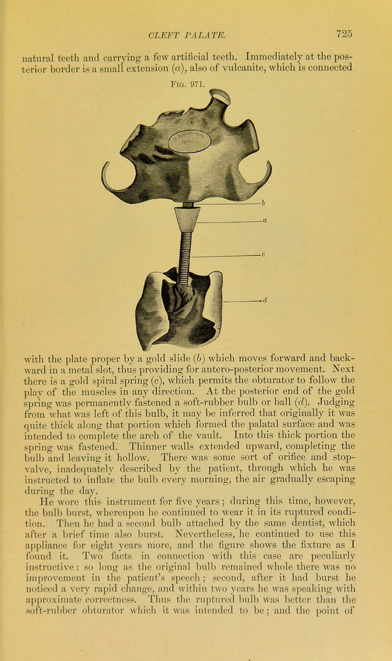 natural teeth and carrying a few artificial teeth. Immediately at the pos- terior border is a small extension (a), also of vulcanite, which is connected Fig. 971. with the plate proper by a gold slide {b) which moves forward and back- ward in a metal slot, thus providing for antero-posterior movement. Next there is a gold spiral spring (c), which permits the obturator to follow the play of the muscles in any direction. At the posterior end of the gold spring was permanently fastened a soft-rubber bulb or ball (d). Judging from what was left of this bulb, it may be inferred that originally it Avas quite thick along that portion which formed the palatal surface and was intended to complete the arch of the vault. Into this thick portion the spring was fastened; Thinner walls extended upward, completing the bulb and leaving it hollow. There was some sort of orifice and stop- valve, inadequately described by the patient, through which he was instructed to inflate the bulb every morning, the air gradually escaping during the day. He wore this instrument for five years; during this time, however, the bulb bur.st, whereupon he continued to wear it in its ruptured condi- tion. Then he had a second bulb attached by the same dentist, which after a brief time also burst. Nevertheless, he continued to use this appliance for eight years more, and the figure shows the fixture as I found it. Two facts in connection with this case are peculiarly instructive : so long as the original bulb remained whole there was no improvement in the patient's speech ; second, after it had burst he noticed a very rapid change, and within two years he was speaking with approximate correctness. Tlius tlie ruptured bulb was better than the soft-rubber obturator which it was intended to be; and the point of
