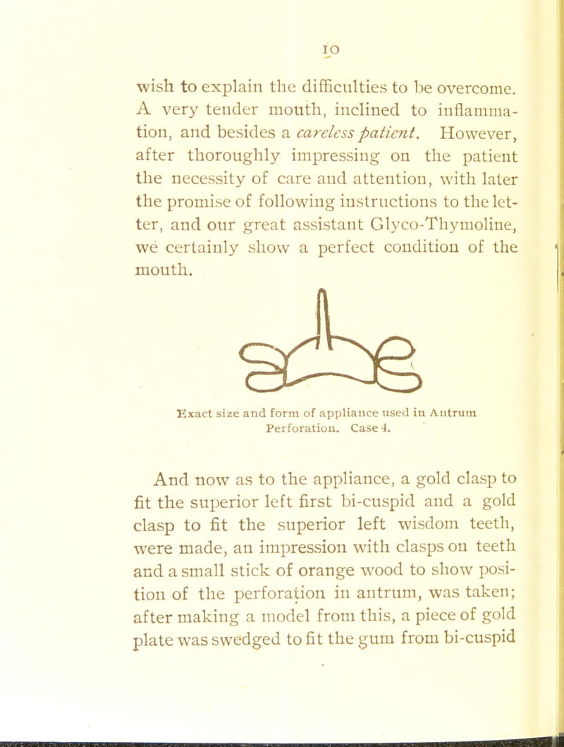 Ip wish to explain the difficulties to be overcome. A very teuder mouth, iucliued to inflamma- tion, and besides a careless patient. However, after thoroughly impressing on the patient the necessity of care and attention, with later the promise of following instructions to the let- ter, and our great assistant Glyco-Thymoline, we certainly show a perfect condition of the mouth. ■ Exact size and form of appliance used in Antrum Perforatiou. Case \. And now as to the appliance, a gold clasp to fit the superior left first bi-cuspid and a gold clasp to fit the superior left wisdom teeth, were made, an impression with clasps on teeth and a small stick of orange wood to show posi- tion of the perforation in antrum, was taken; after making a model from this, a piece of gold plate was swedged to fit the gum from bi-cuspid
