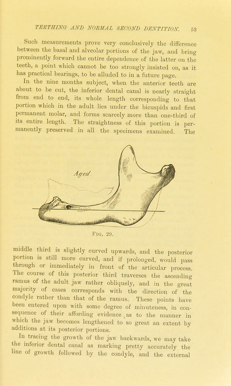 Such measurements prove very conclusively the difference between the basal and alveolar portions of the jaw, and bring prominently forward the entire dependence of the latter on the teeth, a point which cannot be too strongly insisted on, as it has practical bearings, to be alluded to in a future page. In the nine months subject, when the anterior teeth are about to be cut, the inferior dental canal is nearly straight from end to end, its whole length corresponding to that portion which in the adult lies under the bicuspids and first permanent molar, and forms scarcely more than one-third of its entire length. The straightness of this portion is per- manently preserved in all the specimens examined. The Aged'. Fig. 29. middle third is slightly curved upwards, and the posterior portion is still more curved, and if prolonged, would pass through or immediately in front of the articular process. The course of this posterior third traverses the ascending ramus of the adult jaw rather obliquely, and in the great majority of cases corresponds with the direction of the condyle rather than that of the ramus. These points have been entered upon with some degree of minuteness, in con- sequence of their affording evidence,as to the manner in which the jaw becomes lengthened to so great an extent by additions at its posterior portions. In tracing the growth of the jaw backwards, wo may take the inferior dental canal as marking pretty accurately the line of growth followed by the condyle, and the external