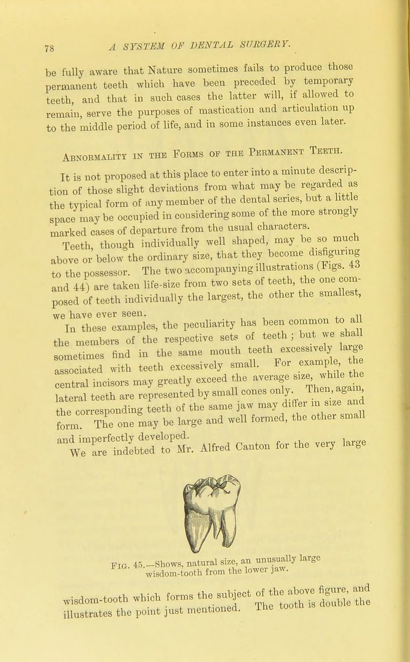 be fully aware that Nature sometimes fails to produce those permanent teeth which have been preceded by temporary teeth, and that in such cases the latter will, if allowed to remain, serve the purposes of mastication and articulation up to the middle period of life, and in some instances even later. Abnormality in the Forms of the Permanent Teeth. It is not proposed at this place to enter into a minute descrip- tion of those slight deviations from what may be regarded as the typical form of any member of the dental series, but a little space may be occupied in considering some of the more strongly marked cases of departure from the usual characters. Teeth, though individually well shaped, may be so much above or below the ordinary size, that they become disfiguring to the possessor. The two accompanying illustrations (Figs. M and 44) are taken life-size from two sets of teeth, the one com- posed of teeth individually the largest, the other the smallest, we have ever seen. In these examples, the peculiarity has been common to a the members of the respective sets of teeth ; but we shal sometimes find in the same mouth teeth excessively large associated with teeth excessively small. For example he Intral incisors may greatly exceed ** average lateral teeth are represented by small cones only. Then again tt ct esponding teeth of the same jaw may differ in size and form The one may be large and well formed, the other small a^:^Ilt M, Alfred Canton for the very large wisdom-tooth which forms the subject g.^ illustrates the point just mentioned. The tootn