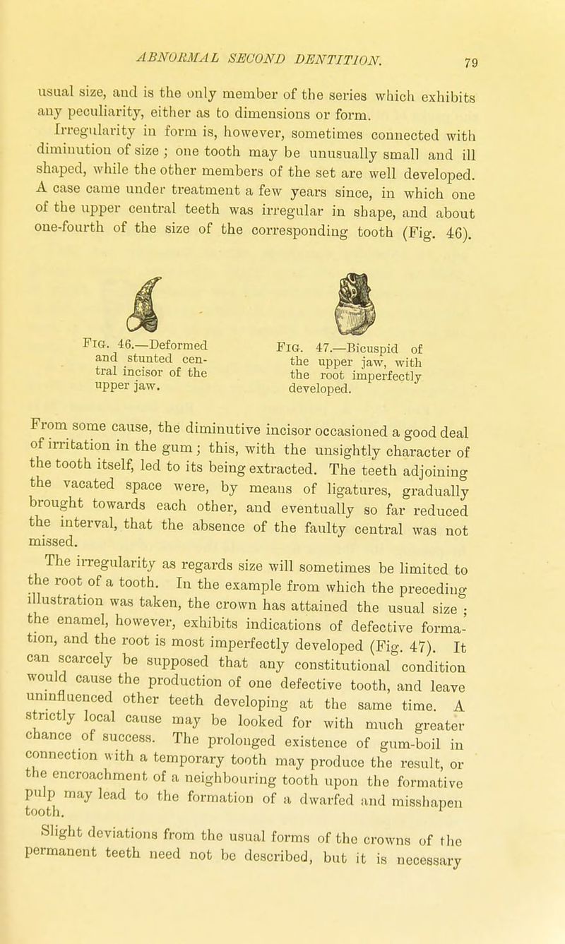 7'J usual size, and is the only member of the series which exhibits any peculiarity, either as to dimensions or form. Irregularity in form is, however, sometimes connected witli diminution of size ; one tooth maybe unusually small and ill shaped, while the other members of the set are well developed. A case came under treatment a few years since, in which one of the upper central teeth was irregular in shape, and about one-fourth of the size of the corresponding tooth (Fig. 46). Fig. 46.—Deformed Fig. 47.—Bicuspid of and stunted cen- the upper jaw, with tral incisor of the the root imperfectly upper jaw. developed. From some cause, the diminutive incisor occasioned a good deal of irritation in the gum; this, with the unsightly character of the tooth itself, led to its being extracted. The teeth adjoining the vacated space were, by means of ligatures, gradually brought towards each other, and eventually so far reduced the interval, that the absence of the faulty central was not missed. The irregularity as regards size will sometimes be limited to the root of a tooth. In the example from which the preceding illustration was taken, the crown has attained the usual size • the enamel, however, exhibits indications of defective forma- tion, and the root is most imperfectly developed (Fig. 47) It can scarcely be supposed that any constitutional condition would cause the production of one defective tooth, and leave uninfluenced other teeth developing at the same time. A strictly local cause may be looked for with much greater chance of success. The prolonged existence of gum-boil in connection with a temporary tooth may produce the result, or the encroachment of a neighbouring tooth upon the formative pulp may lead to the formation of a dwarfed and misshapen tooth. r Slight deviations from the usual forms of the crowns of the permanent teeth need not be described, but it is necessary