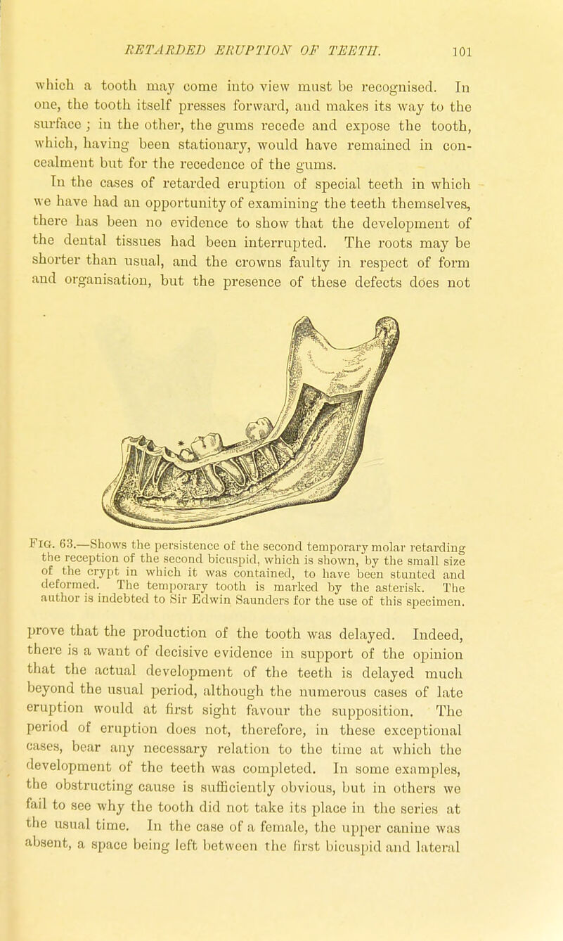 which a tootli may come into view must be recognised. In one, the tooth itself presses forward, and makes its way to the surface ; in the other, the gums recede and expose the tooth, which, having been stationary, would have remained in con- cealment but for the recedence of the gums. In the cases of retarded eruption of special teeth in which we have had an opportunity of examining the teeth themselves, there has been no evidence to show that the development of the dental tissues had been interrupted. The roots may be shorter than usual, and the crowns faulty in respect of form and organisation, but the presence of these defects does not Fig. 63.—Shows the persistence of the second temporary molar retarding the reception of the second bicuspid, which is shown, by the small size of the crypt in which it was contained, to have been stunted and deformed. The temporary tooth is marked by the asterisk. The author is indebted to Sir Edwin Saunders for the use of this specimen. prove that the production of the tooth was delayed. Indeed, there is a want of decisive evidence in support of the opinion that the actual development of the teeth is delayed much beyond the usual period, although the numerous cases of late eruption would at first sight favour the supposition. The period of eruption does not, therefore, in these exceptional crises, bear any necessary relation to the time at which the development of the teeth was completed. In some examples, the obstructing cause is sufficiently obvious, but in others we fail to see why the tooth did not take its place in the series at the usual time. In the case of a female, the upper canine was absent, a space being left between the first bicuspid and lateral