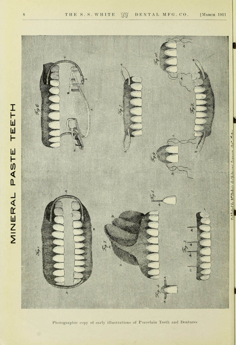 I'liotoeraphic copy of early ilhisi ralions of Porcelain Teeth and Dentures