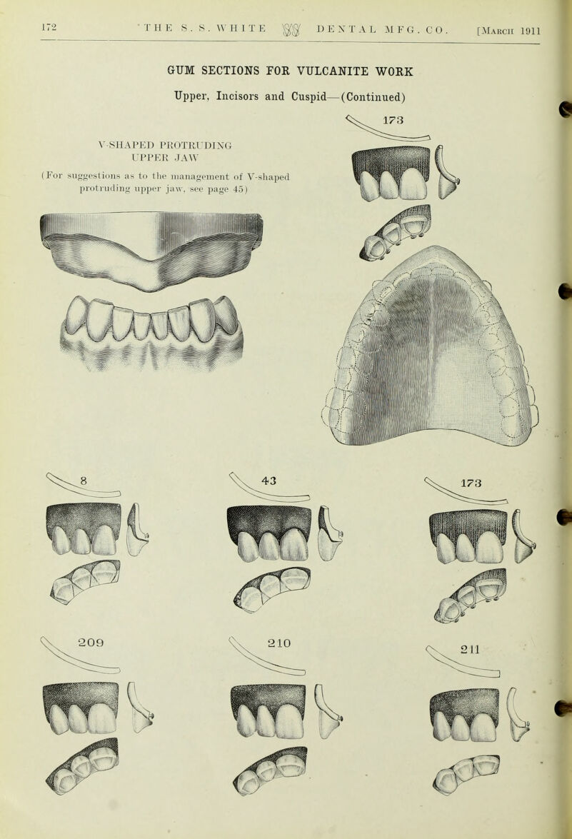 GUM SECTIONS FOR VULCANITE WORK Upper, Incisors and Cuspid—(Continued) <^ 173