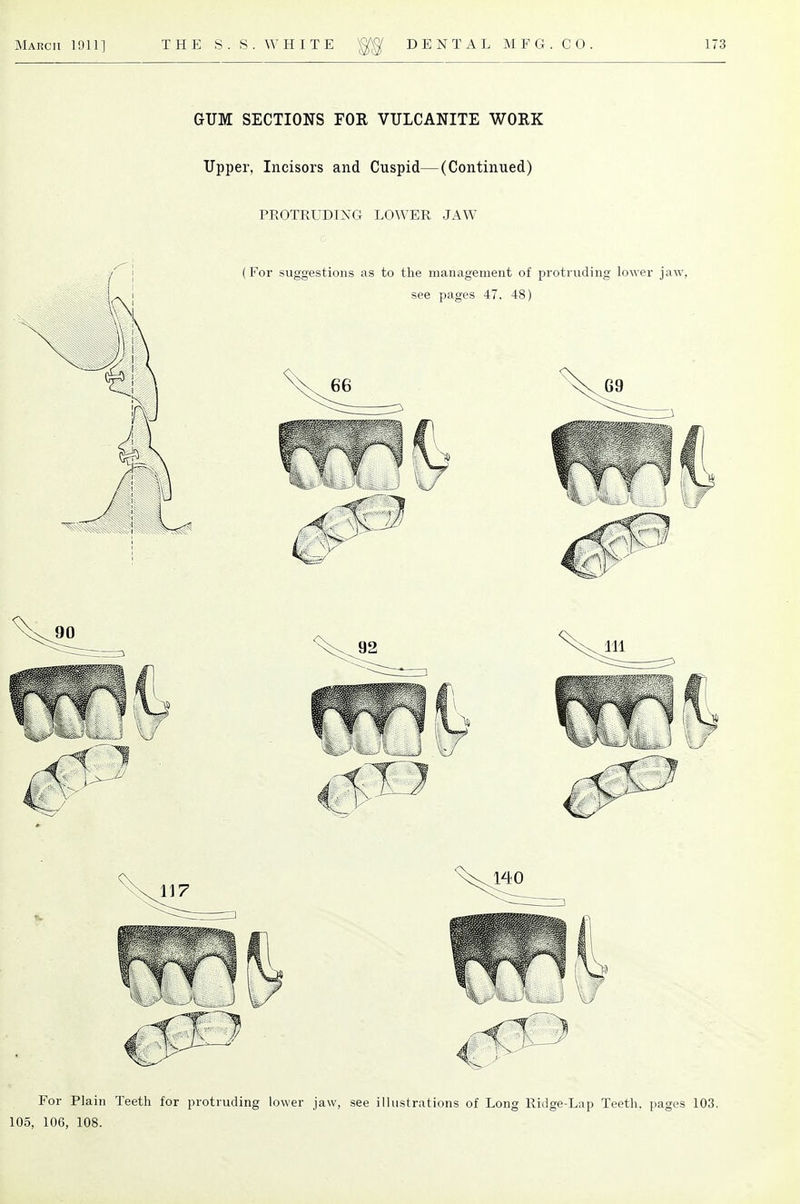 GUM SECTIONS FOR VULCANITE WORK Upper, Incisors and Cuspid—(Continued) PROTRUDING LOWER JAW For Plain Teeth for protruding lower jaw, see illustrations of Long Ridge-Lap Teeth, pages 103. 105, 106, 108.