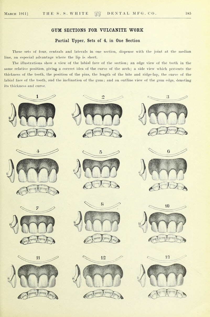 GUM SECTIONS FOR VULCANITE WORK Partial Upper, Sets of 4, in One Section These sets of four, centrals and laterals in one section, dispense with the joint at the median line, an especial advantage where the lip is short. The illustrations show a view of the labial face of the section; an edge view of the teeth in the same relative position, giving a correct idea of the curve of the arch; a side view which presents the thickness of the tooth, the position of the pins, the length of the bite and ridge-lap, the curve of the labial face of the tooth, and the inclination of the gum; and an outline view of the gum edge, denoting its thickness and curve.