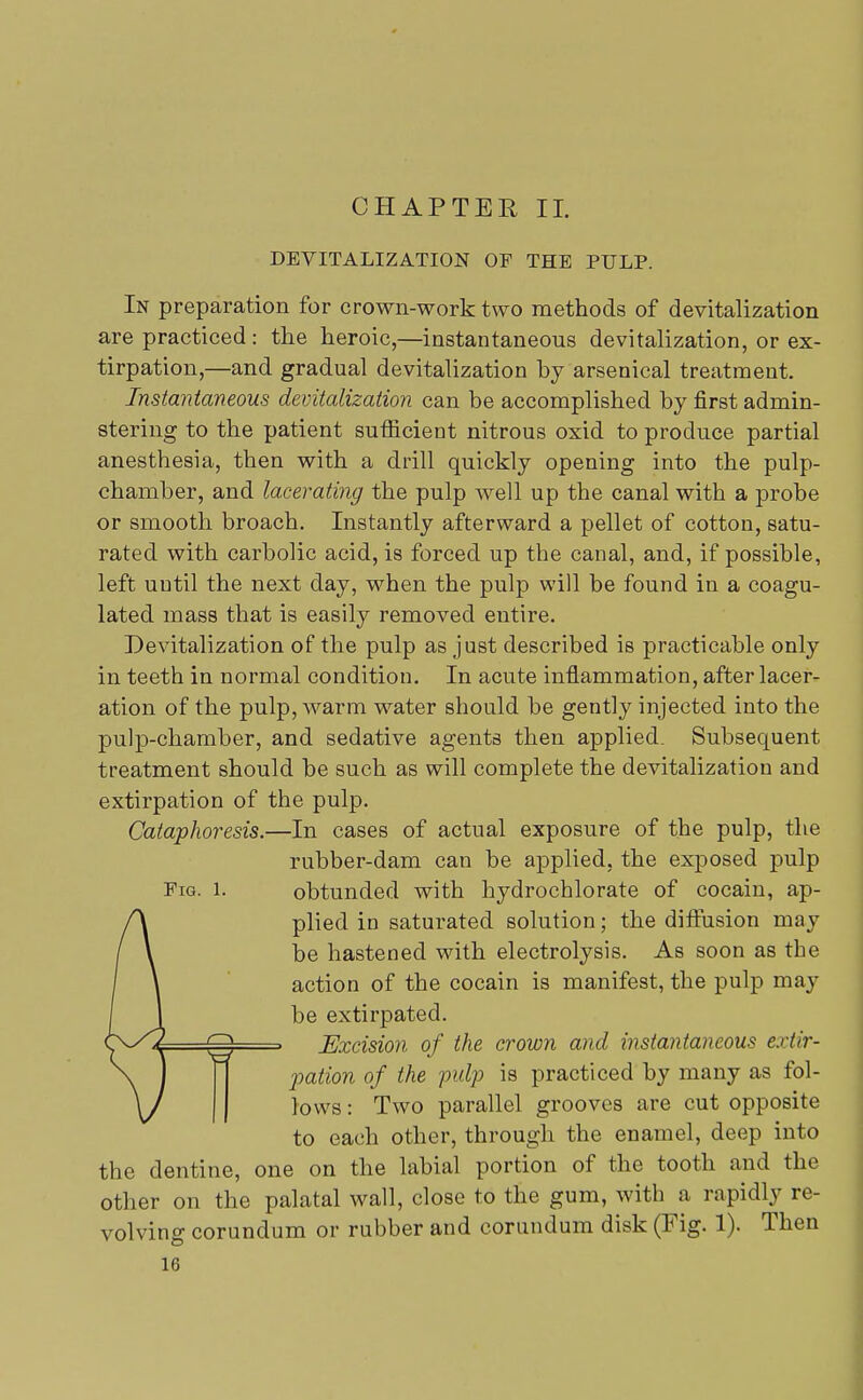 DEVITALIZATION OF THE PULP. In preparation for crown-work two methods of devitalization are practiced: the heroic,—instantaneous devitalization, or ex- tirpation,—and gradual devitalization by arsenical treatment. Instantaneous devitalization can be accomplished by first admin- stering to the patient sufficient nitrous oxid to produce partial anesthesia, then with a drill quickly opening into the pulp- chamber, and lacerating the pulp well up the canal with a probe or smooth broach. Instantly afterward a pellet of cotton, satu- rated with carbolic acid, is forced up the canal, and, if possible, left uutil the next day, when the pulp will be found in a coagu- lated mass that is easily removed entire. Devitalization of the pulp as just described is practicable only in teeth in normal condition. In acute inflammation, after lacer- ation of the pulp, warm water should be gently injected into the pulp-chamber, and sedative agents then applied. Subsecpient treatment should be such as will complete the devitalization and extirpation of the pulp. Cataphoresis.—In cases of actual exposure of the pulp, the rubber-dam can be applied, the exposed pulp Fig. l. obtunded with hydrochlorate of cocain, ap- plied in saturated solution; the diffusion may be hastened with electrolysis. As soon as the action of the cocain is manifest, the pulp may be extirpated. Excision of the crown and instantaneous extir- pation of the pulp is practiced by many as fol- lows : Two parallel grooves are cut opposite to each other, through the enamel, deep into the dentine, one on the labial portion of the tooth and the other on the palatal wall, close to the gum, with a rapidly re- volving corundum or rubber and corundum disk (Fig. 1). Then