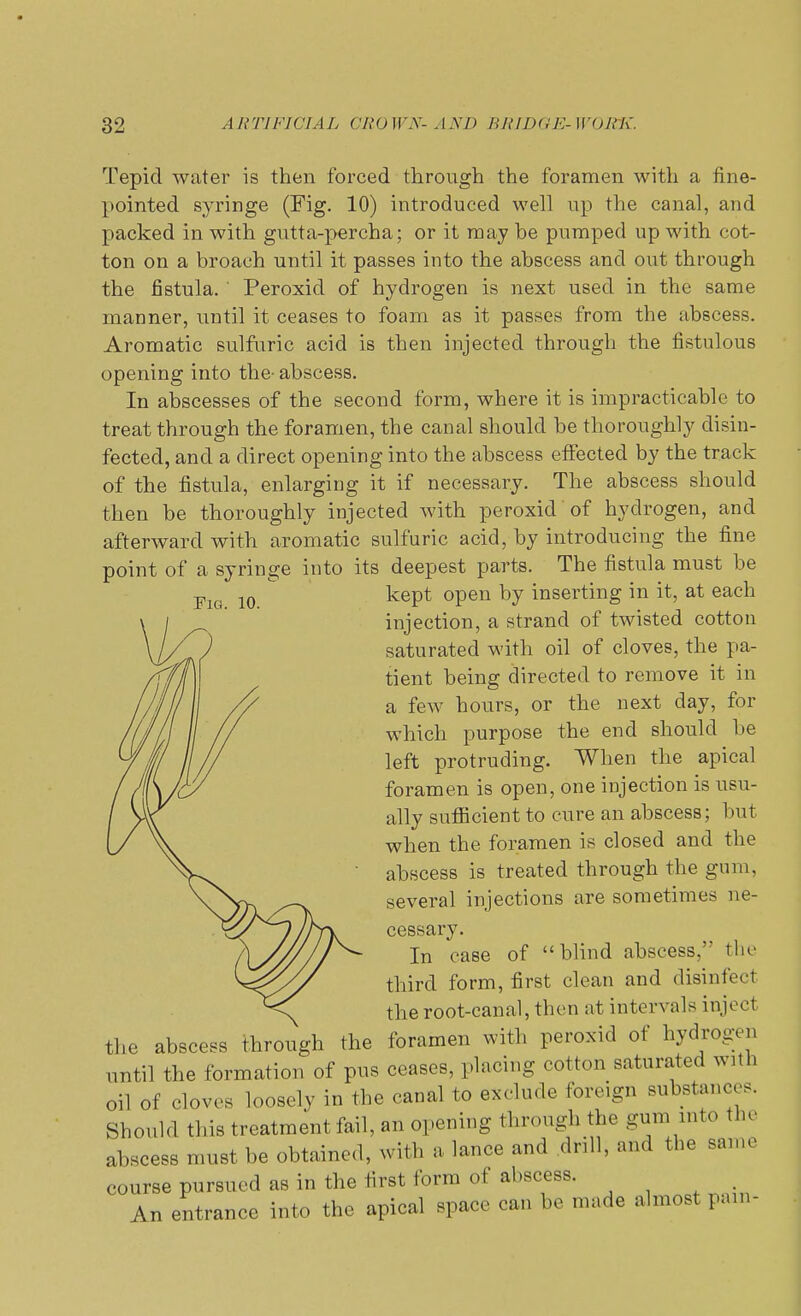 Tepid water is then forced through the foramen with a fine- pointed syringe (Fig. 10) introduced well up the canal, and packed in with gutta-percha; or it may be pumped up with cot- ton on a broach until it passes into the abscess and out through the fistula. ' Peroxid of hydrogen is next used in the same manner, until it ceases to foam as it passes from the abscess. Aromatic sulfuric acid is then injected through the fistulous opening into the- abscess. In abscesses of the second form, where it is impracticable to treat through the foramen, the canal should be thoroughly disin- fected, and a direct opening into the abscess effected by the track of the fistula, enlarging it if necessary. The abscess should then be thoroughly injected with peroxid of hydrogen, and afterward with aromatic sulfuric acid, by introducing the fine point of a syringe into its deepest parts. The fistula must be kept open by inserting in it, at each injection, a strand of twisted cotton saturated with oil of cloves, the pa- tient being directed to remove it in a few hours, or the next day, for which purpose the end should be left protruding. When the apical foramen is open, one injection is usu- ally sufficient to cure an abscess; but when the foramen is closed and the abscess is treated through the gum. several injections are sometimes ne- cessary. In case of blind abscess, the third form, first clean and disinfect the root-canal, then at intervals inject foramen with peroxid of hydro^ n ceases, placing cotton saturated with oil of cloves loTselyVthe canal to exclude foreign substances. Should this treatment fail, an opening through the gum into the abscess must be obtained, with a lance and drill, and the same course pursued as in the first form of abscess. An entrance into the apical space can be made almost pam- the abscess through the until the formation of pus