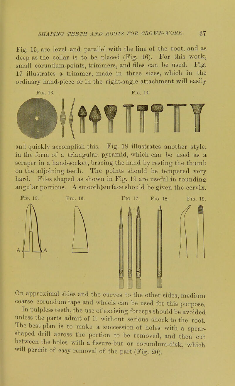 Fig. 15, are level and parallel with the line of the root, and as deep as the collar is to be placed (Fig. 16). For this work, small corundum-points, trimmers, and files can be used; Fig. 17 illustrates a trimmer, made in three sizes, which in the ordinary hand-piece or in the right-angle attachment will easily Fig. 13. Fig. 14. and quickly accomplish this. Fig. 18 illustrates another style, in the form of a triangular pyramid, which can be used as a scraper in a hand-socket, bracing the hand by resting the thumb on the adjoining teeth. The points should be tempered very hard. Files shaped as shown in Fig. 19 are useful in rounding angular portions. A smoothlsurface should be given the cervix. Fig. 15. Fig. 16. Fig. 17. Fig. 18. Fig. 19. On approximal sides and the curves to the other sides, medium coarse corundum tape and wheels can be used for this purpose. In pulpless teeth, the use of excising forceps should be avoided unless the parts admit of it without serious shock to the root. The best plan is to make a succession of holes with a spear- shaped drill across the portion to be removed, and then cut between the holes with a fissure-bur or corundum-disk, which will permit of easy removal of the part (Fig. 20).