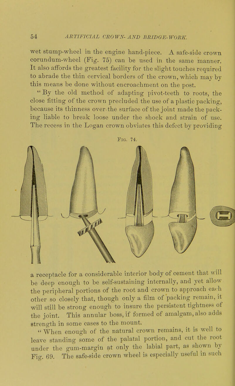 wet stump-wheel in the engine hand-piece. A safe-side crown corunclum-wheel (Fig. 75) can be used in the same manner. It also affords the greatest facility for the slight touches required to abrade the thin cervical borders of the crown, which may by this means be done without encroachment on the post. By the old method of adapting pivot-teeth to roots, the close fitting of the crown precluded the use of a plastic packing, because its thinness over.the surface of the joint made the pack- ing liable to break loose under the shock and strain of use. The recess in the Logan crown obviates this defect by providing Fig. 74. a receptacle for a considerable interior body of cement that will be deep enough to be self-sustaining internally, and yet allow the peripheral portions of the root and crown to approach eai-h other so closely that, though only a film of'packing remain, it will still be Btrong enough to insure the persistent tightness of the joint. This annular boss, if formed of amalgam, also adds strength in some cases to the mount. When enough of the natural crown remains, it is well to leave standing some of the palatal portion, and cut the root under the gum-margiu at only the labial part, as shown by Fi°\ 69. The safe-side crown wheel is especially useful in such